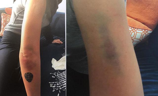 Sıla bu fotoğraflarla Ahmet Kural’dan şikayetçi oldu