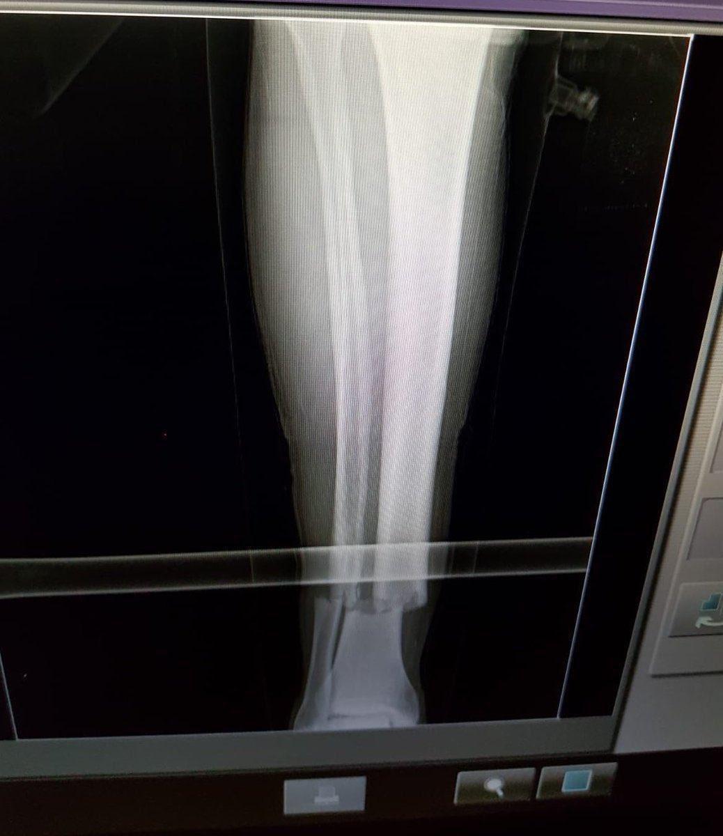 Galatasaraydan Emre Akbaba açıklaması