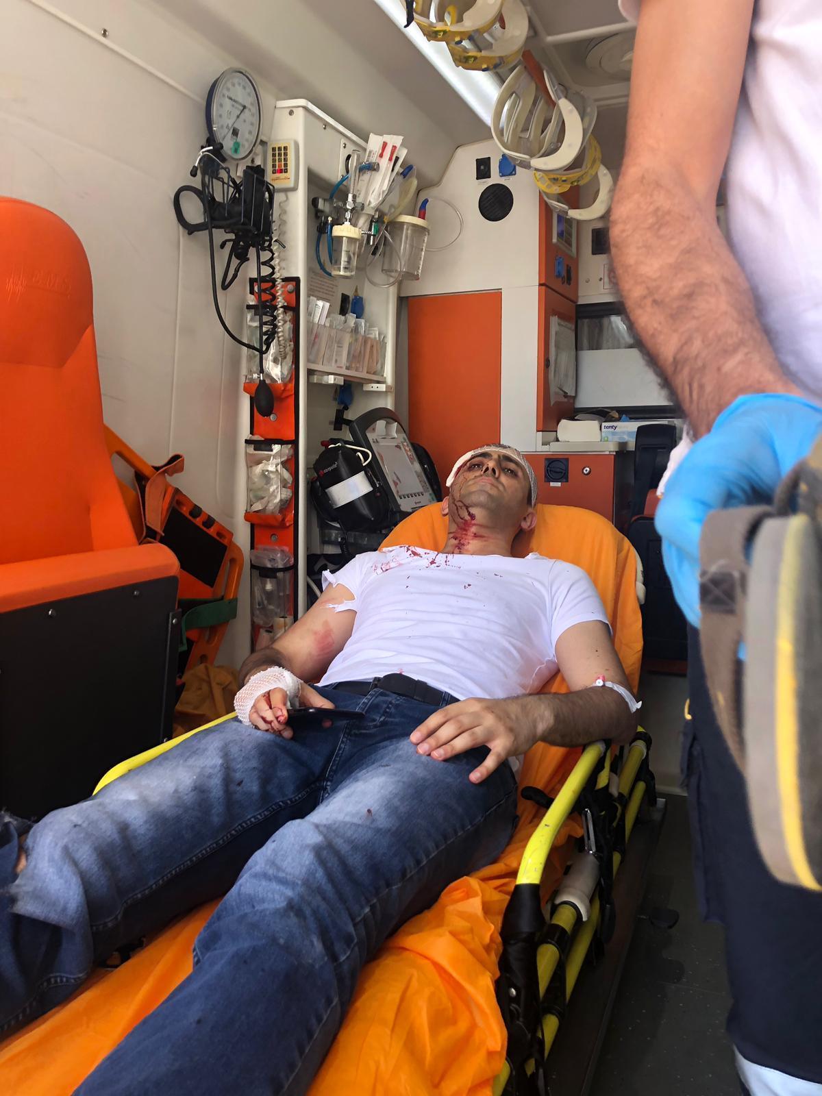 Akit TV Haber Müdürü Murat Alan saldırıya uğradı