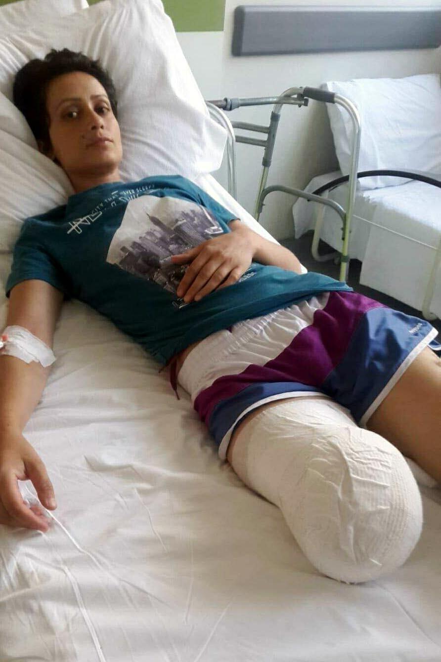 Eşinin vurduğu yazarın bacağı kesildi