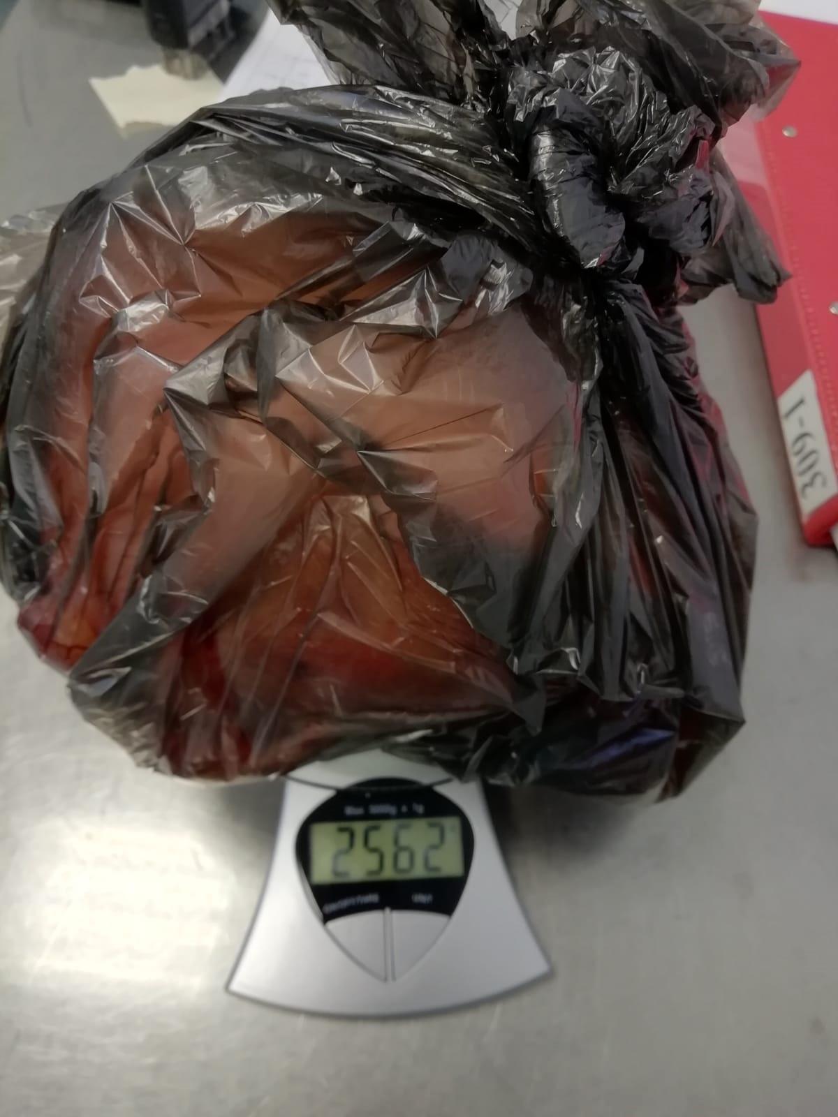 Rahminden 2,5 kiloluk ur çıkarıldı
