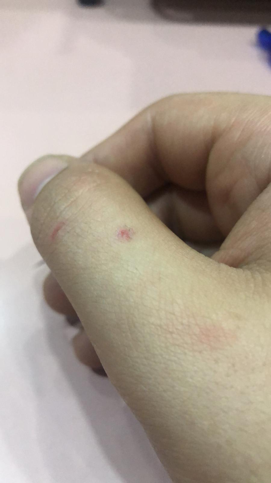 Asya Kaplan Sivrisineğine karşı biyolojik mücadele çalışmaları başladı