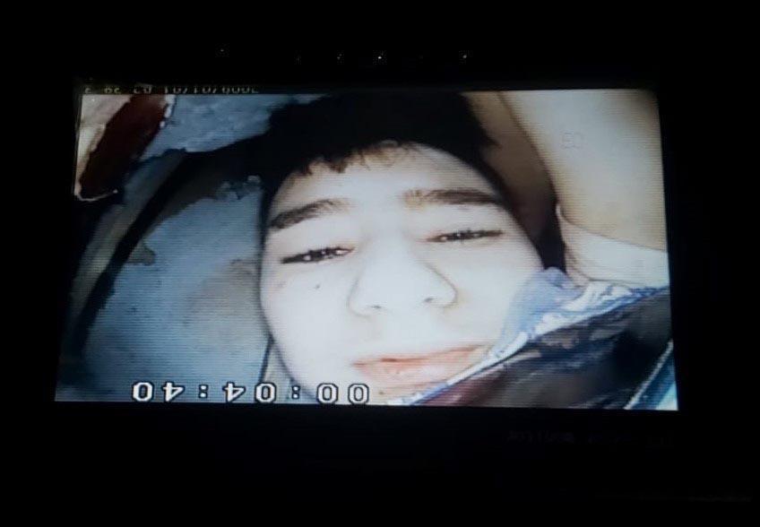15 yaşındaki Günay Özışıkın kurtarılma anı yılan kamera ile görüntülenmiş