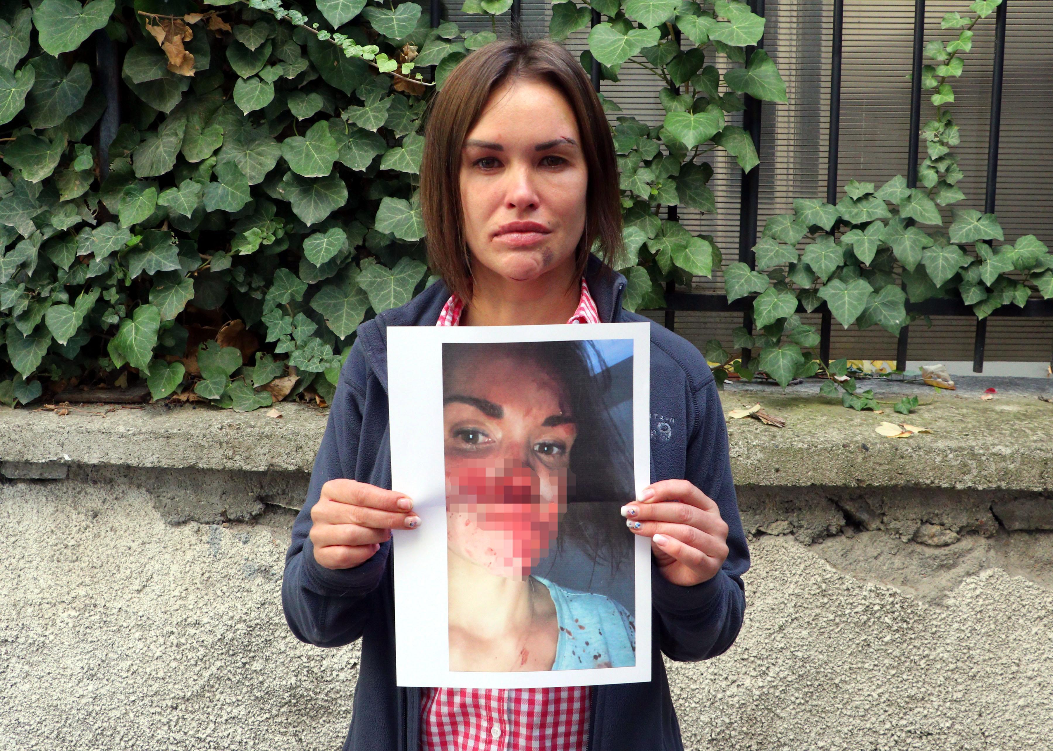 Ölü bulunan Rus güzellik uzmanının tırnak altından alınan doku örnekleri incelenecek