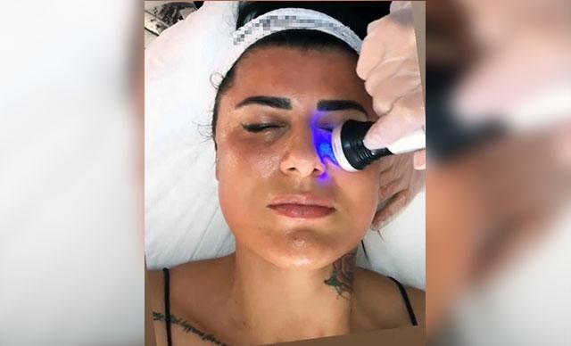 Gittiği güzellik merkezleri yüzünü yaktı, harcadığı parayı isteyince tehdit edildi