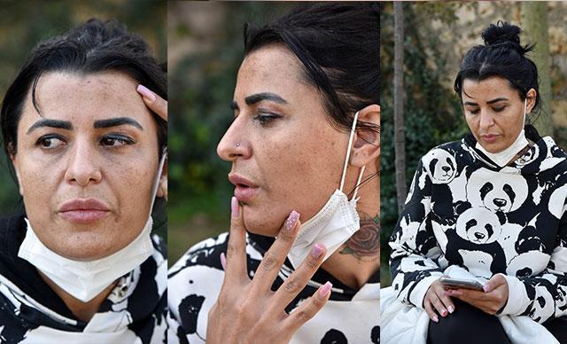 Gittiği güzellik merkezleri yüzünü yaktı, harcadığı parayı isteyince tehdit edildi