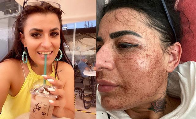 Gittiği güzellik merkezleri yüzünü yaktı, harcadığı parayı isteyince tehdit edildi