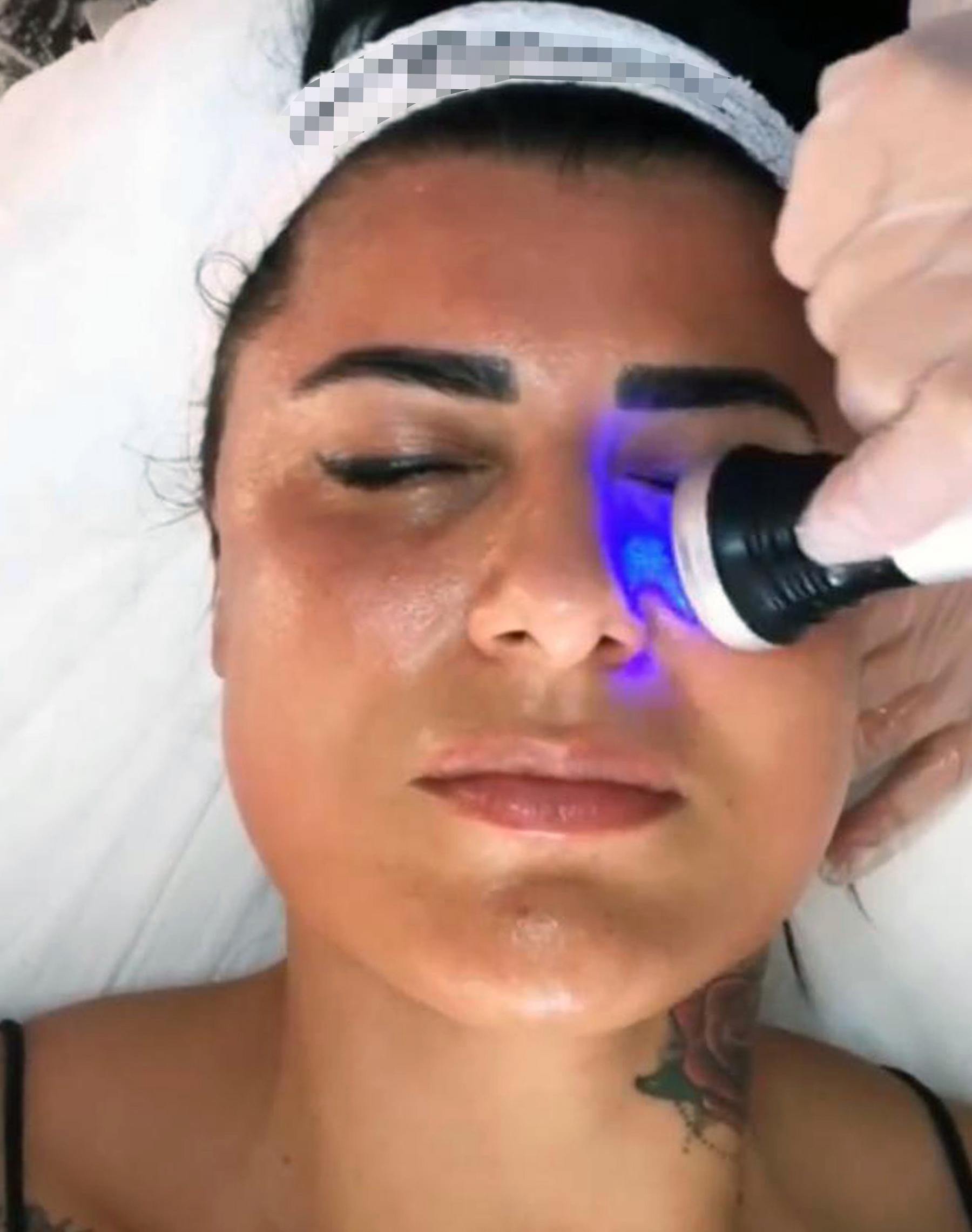 Güzellik merkezinde yüzü yanan Aslı: Sosyal medyadaki reklamlarına kandım