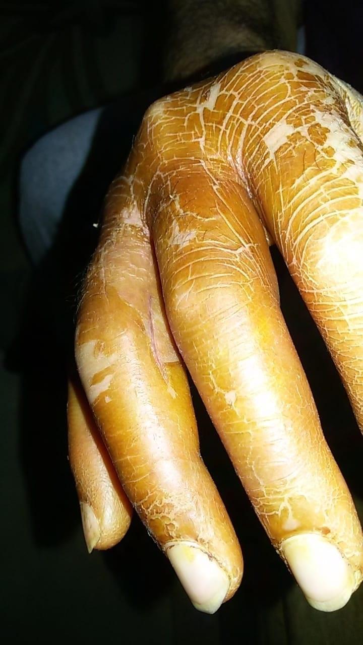 Eline batan kürdan kabusu oldu; Arkadaşlarımı arayıp helallik istedim