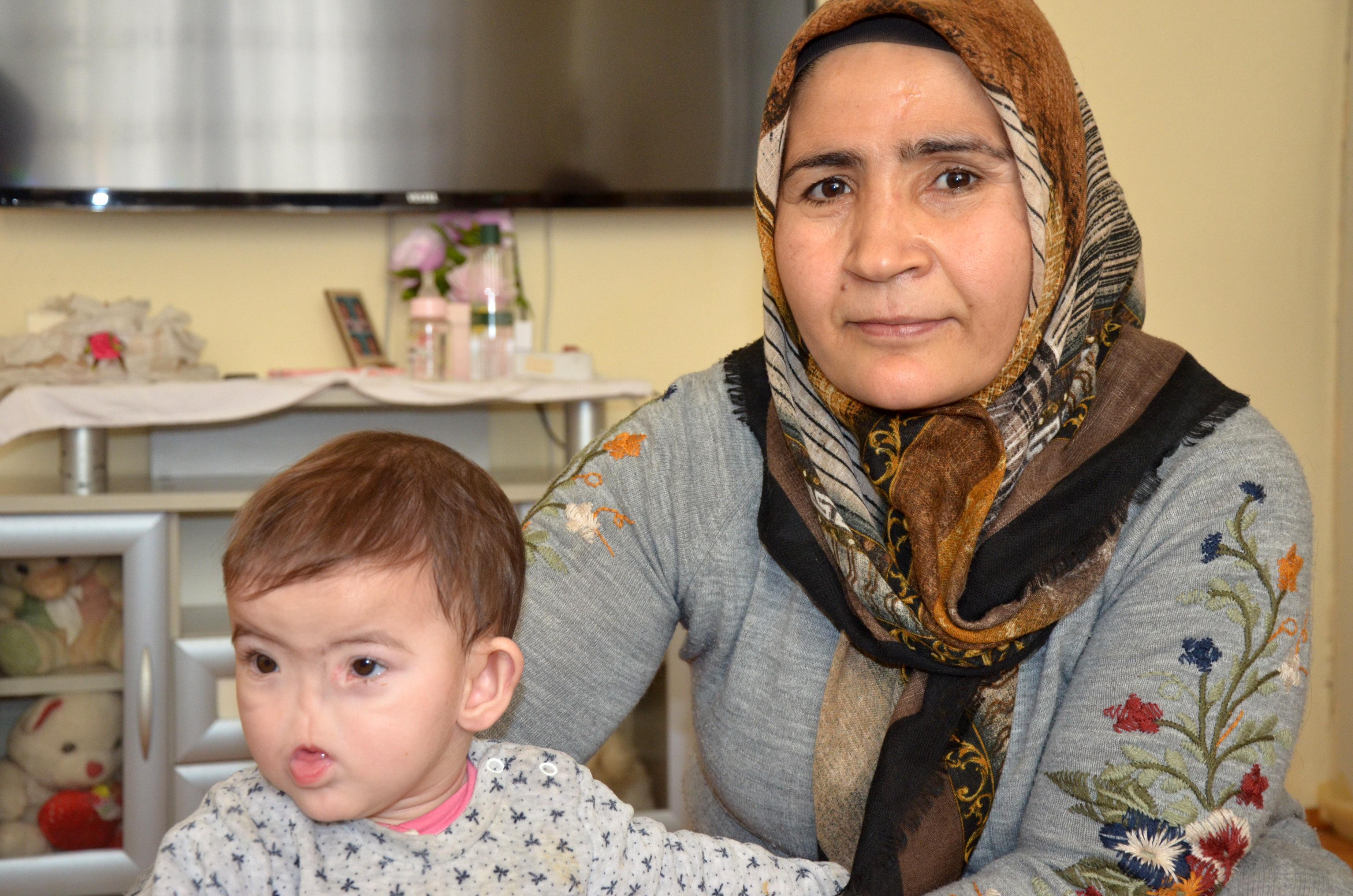 Doğuştan burunsuz dünyaya gelen Amine ve kardeşi Erva aynı kaderi paylaşıyor