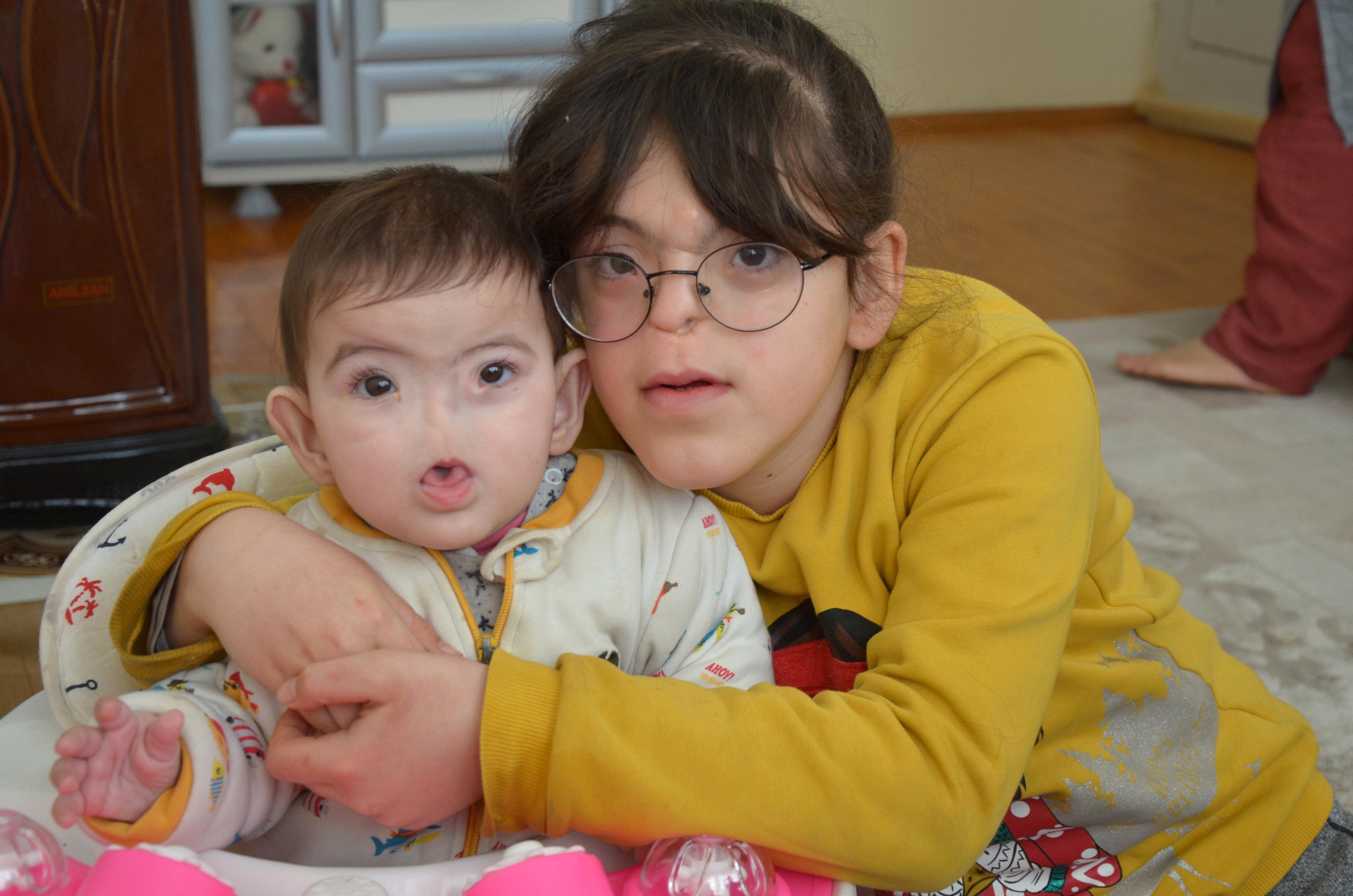 Doğuştan burunsuz dünyaya gelen Amine ve kardeşi Erva aynı kaderi paylaşıyor