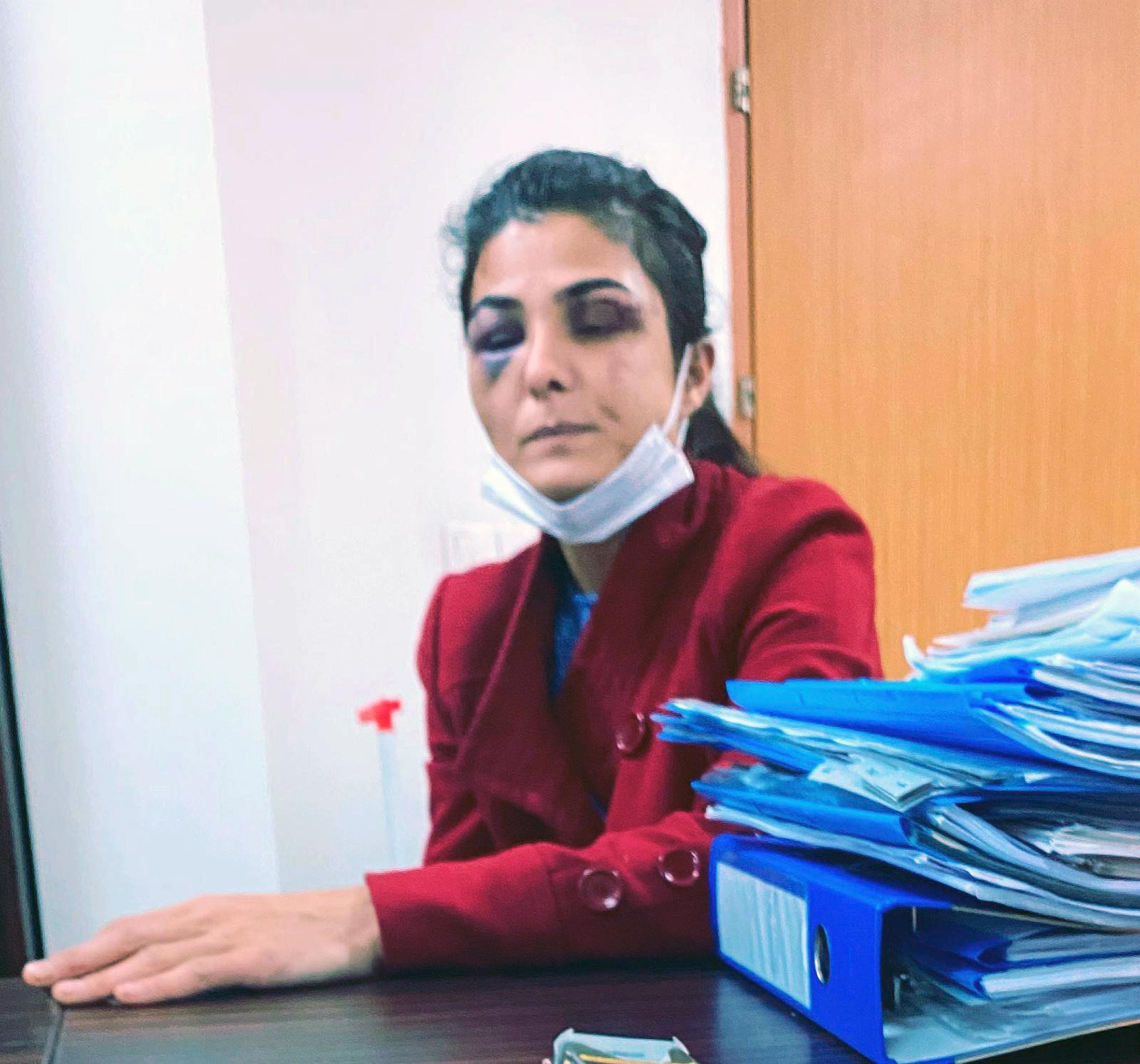 İşkenceci eşini öldüren Melek İpek: Rüyasında onu terk ettiğimi görür, döverdi