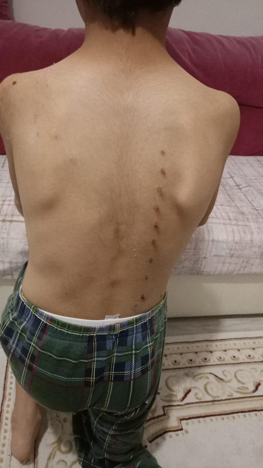 Köpeklerle oynayan 3 çocuğa tırmıkla saldıran hemşire tutuklandı