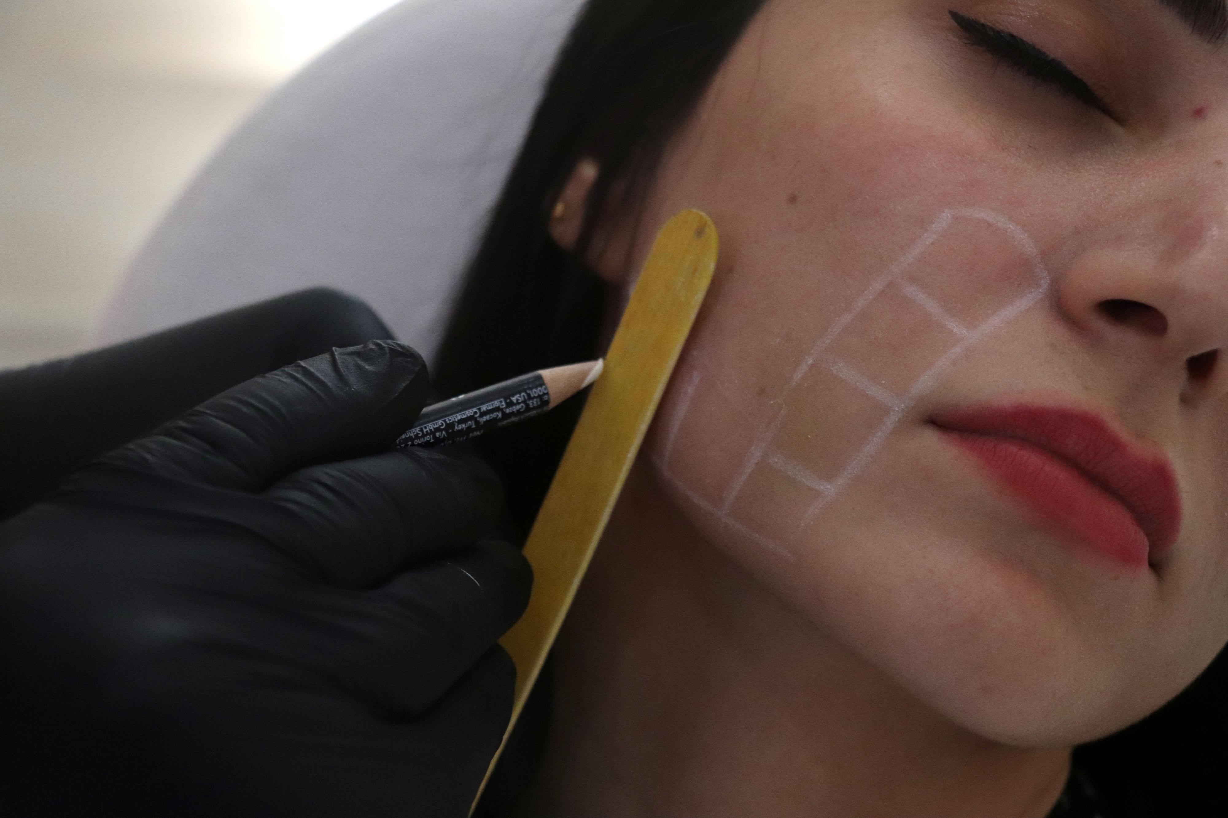 “Ameliyatsız yüz germede endopeel yöntemi kullanılabilir”