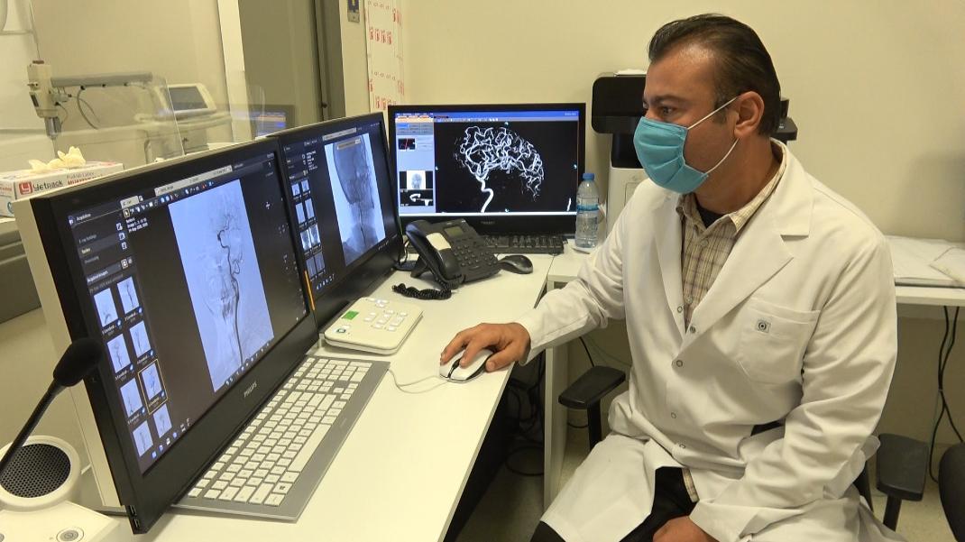 Kan sulandırıcı kullanan hastalarda beyin kanaması, ölümcül netice verebilir