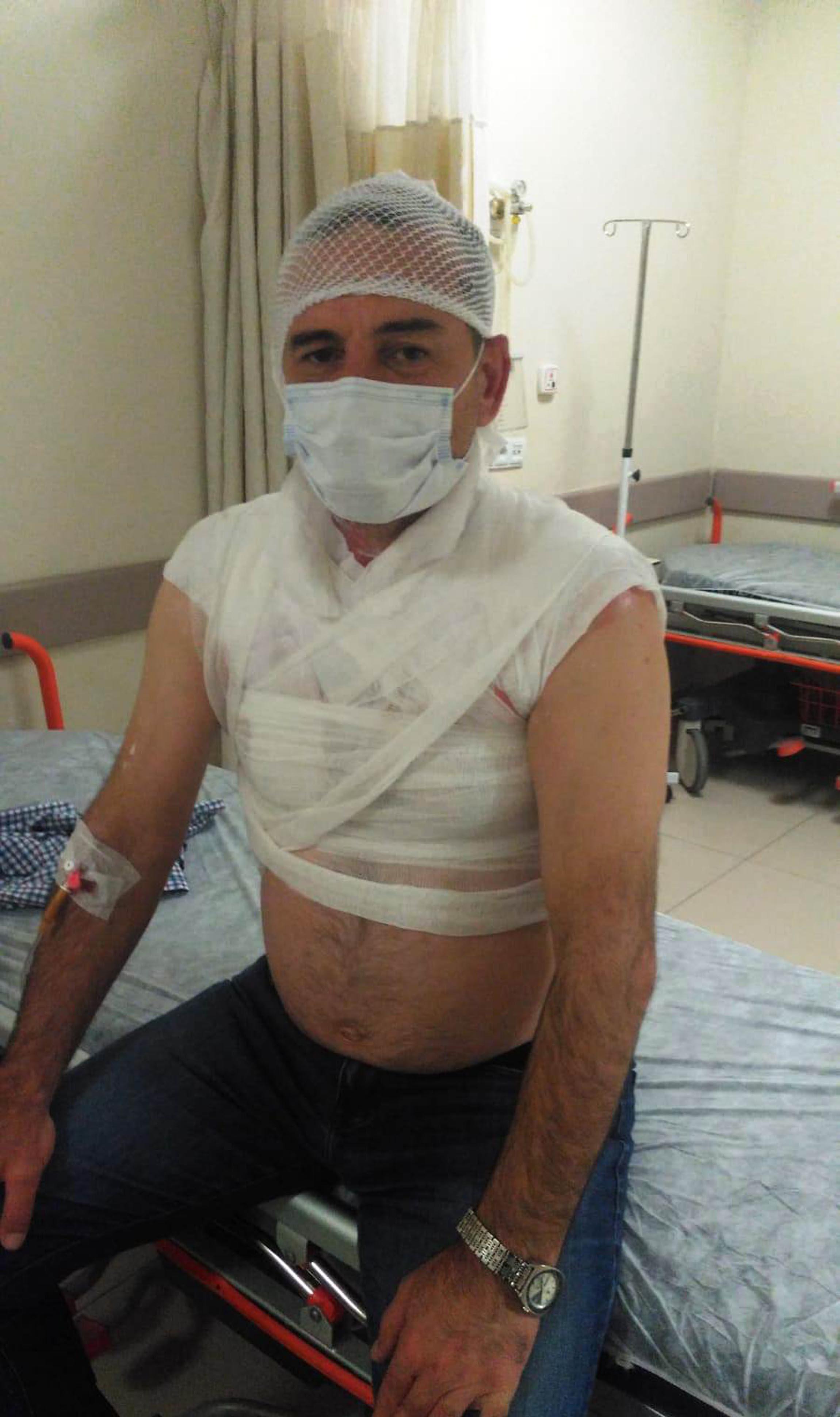 Tartıştığı komşusunun üzerine kaynar su döktü