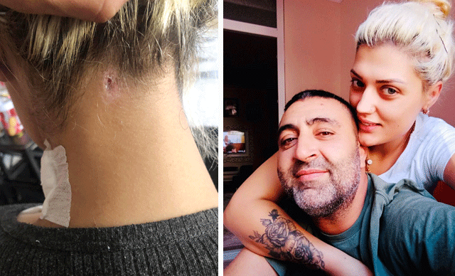 Sevgilisinin ensesinden vurduğu Zeliha: Öldürülmekten korkuyorum