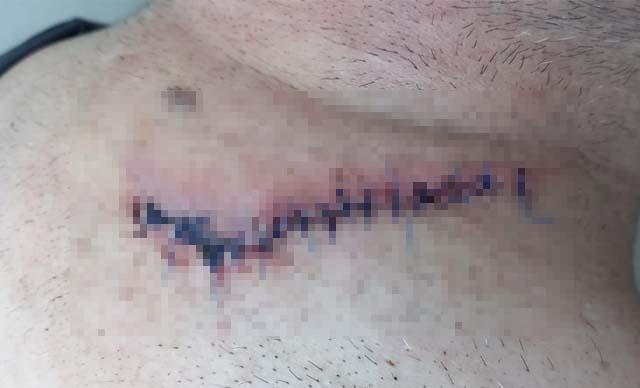 Marketteki sıra tartışmasında dehşet: 3 jandarma görevlisini yaraladı, serbest kaldı