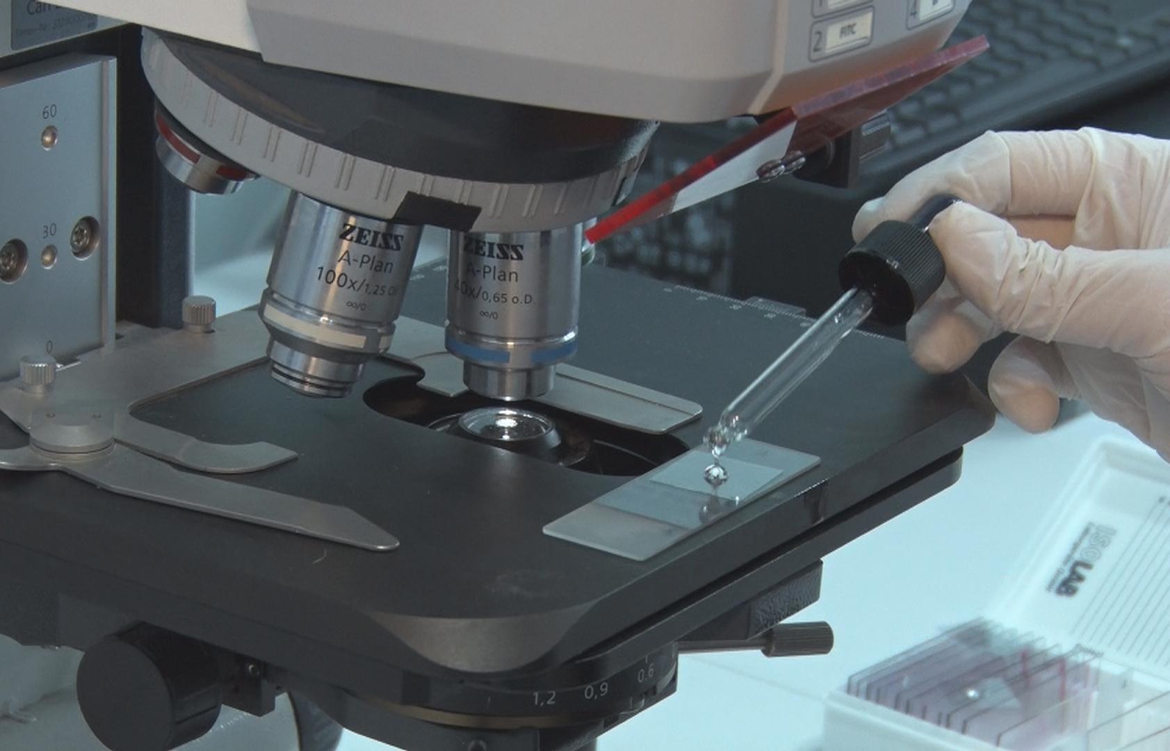 Türkiyede ilk, kan uyuşmazlığı tedavisinde kesin çözüm olacak