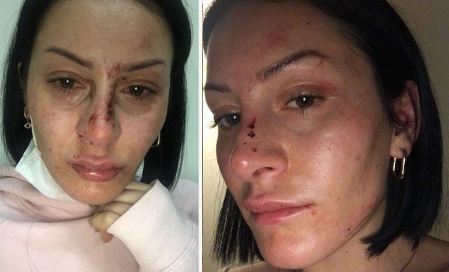 Esenyurtta polisin kadına darp görüntüleri... İstanbul Emniyet Müdürlüğü açıklama yaptı