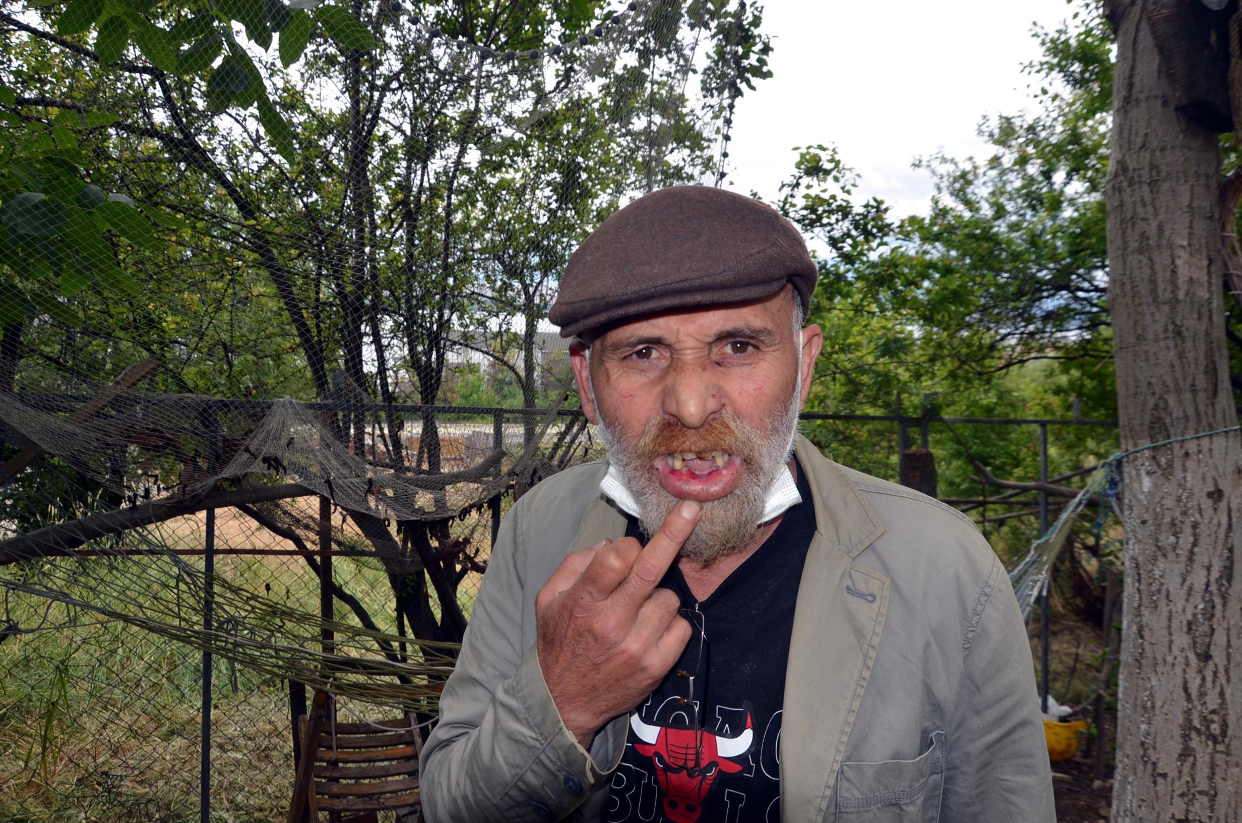 Komşu kavgasında tiyatrocunun keserle 3 dişi kırıldı