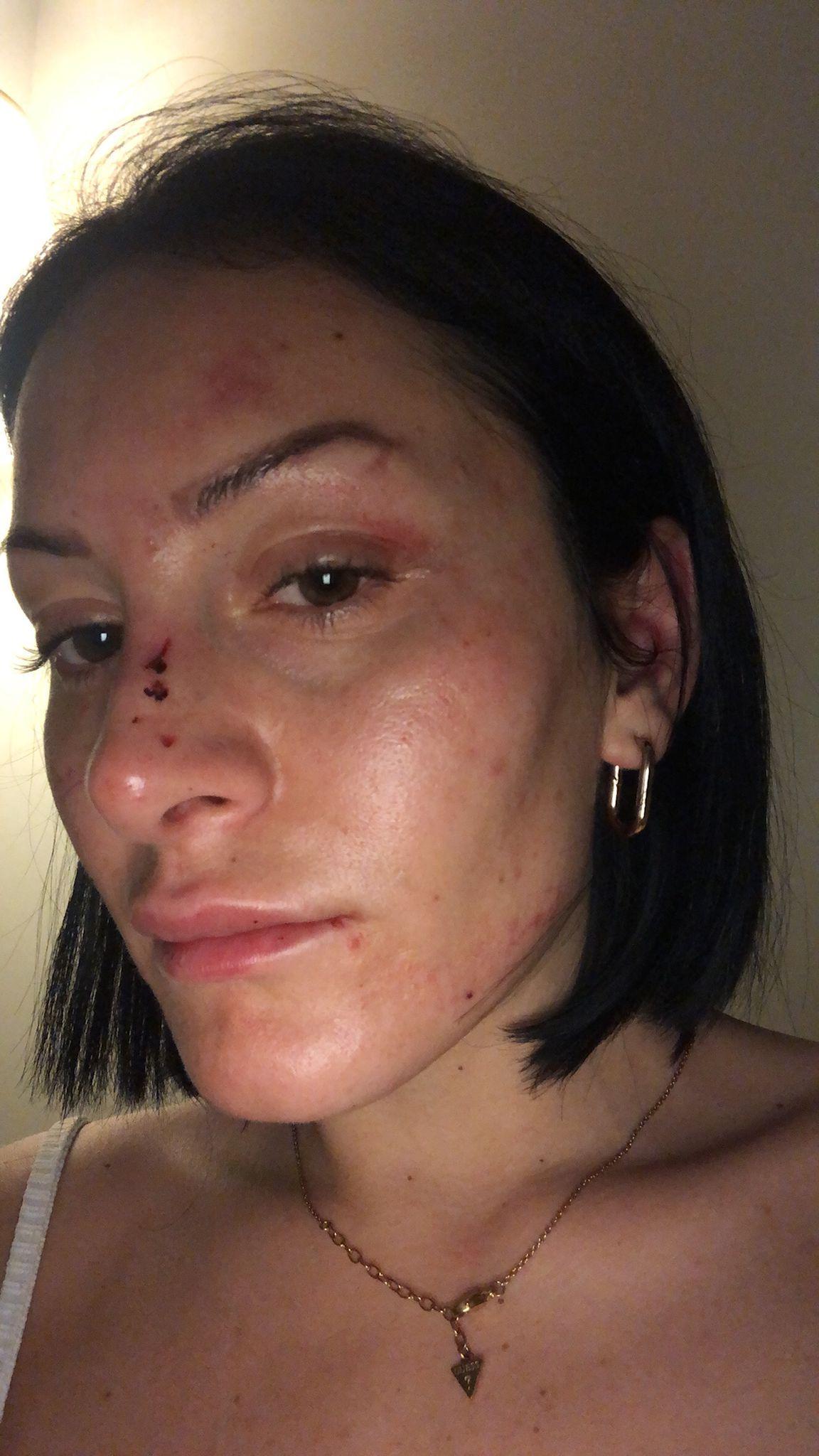 Polisin dövdüğü kadına emniyet müdüründen çiçek