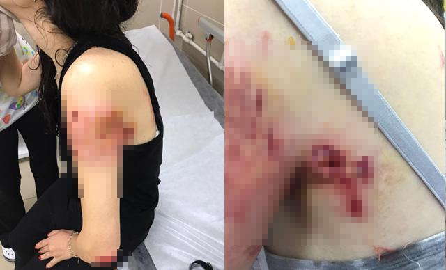 Sarıyerde işe gitmek için evden çıkan genç kıza, sokak köpekleri saldırdı