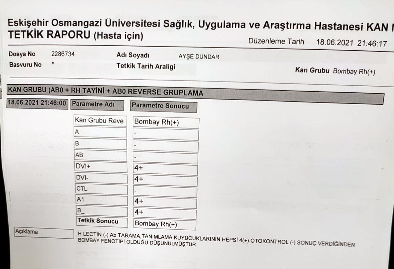 Böbrek hastası Ayşe Dündar için 250 bin kişide 1 görülen ‘Bombay’ grubu kan aranıyor