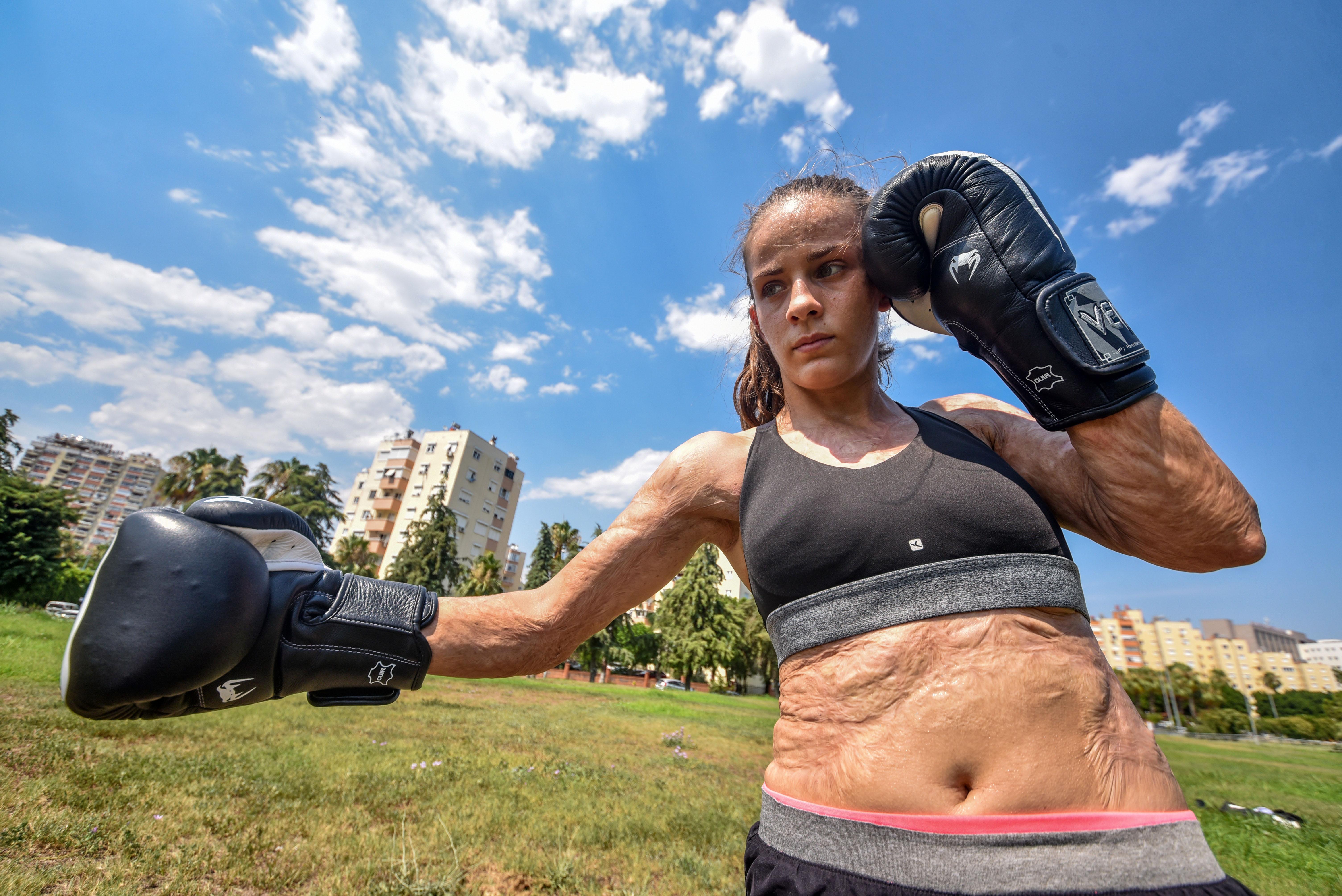 Dilara, acılarını şampiyonluklarla unutuyor