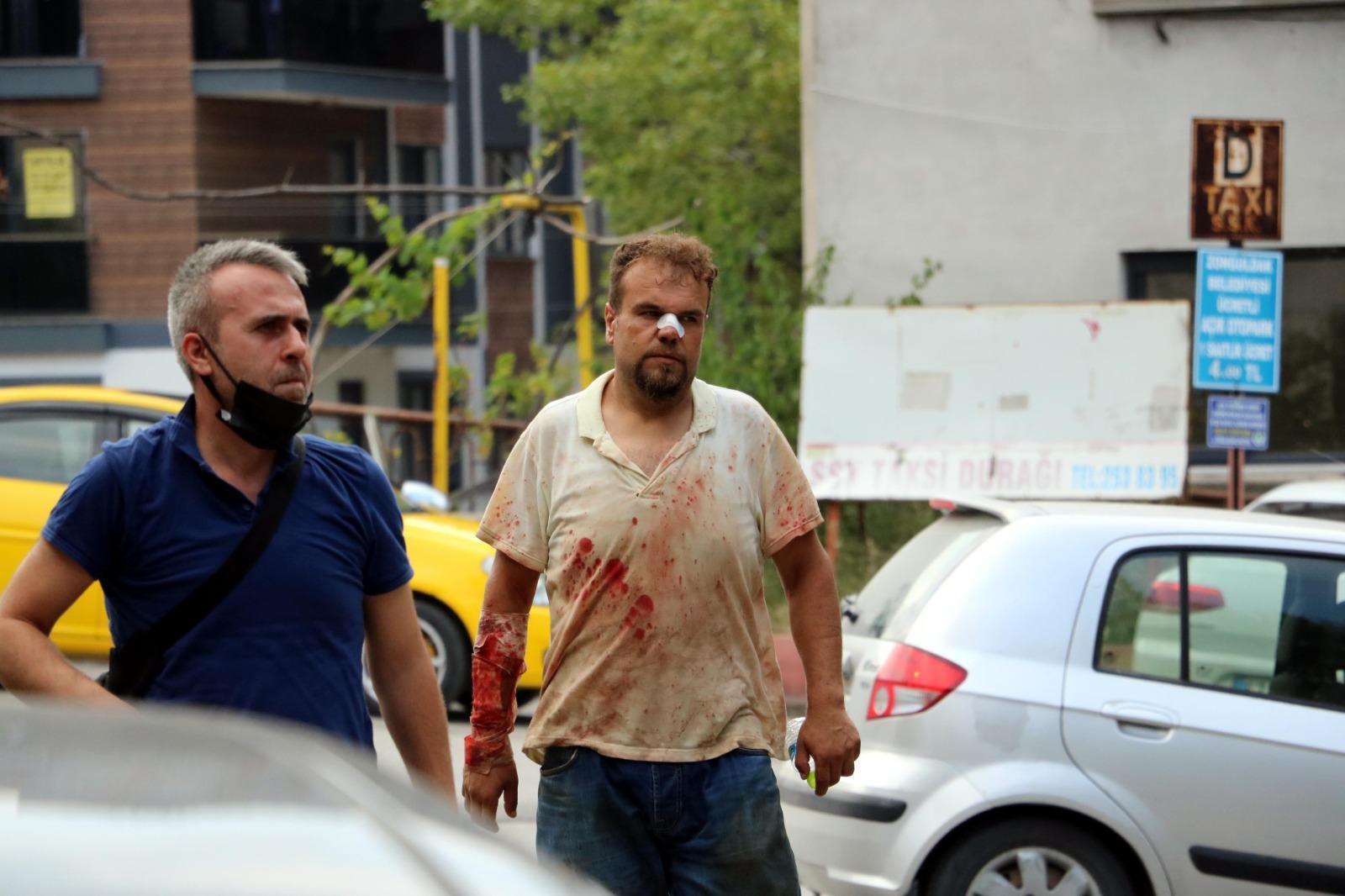 Bursada acemi kasaplar hastanelik oldu