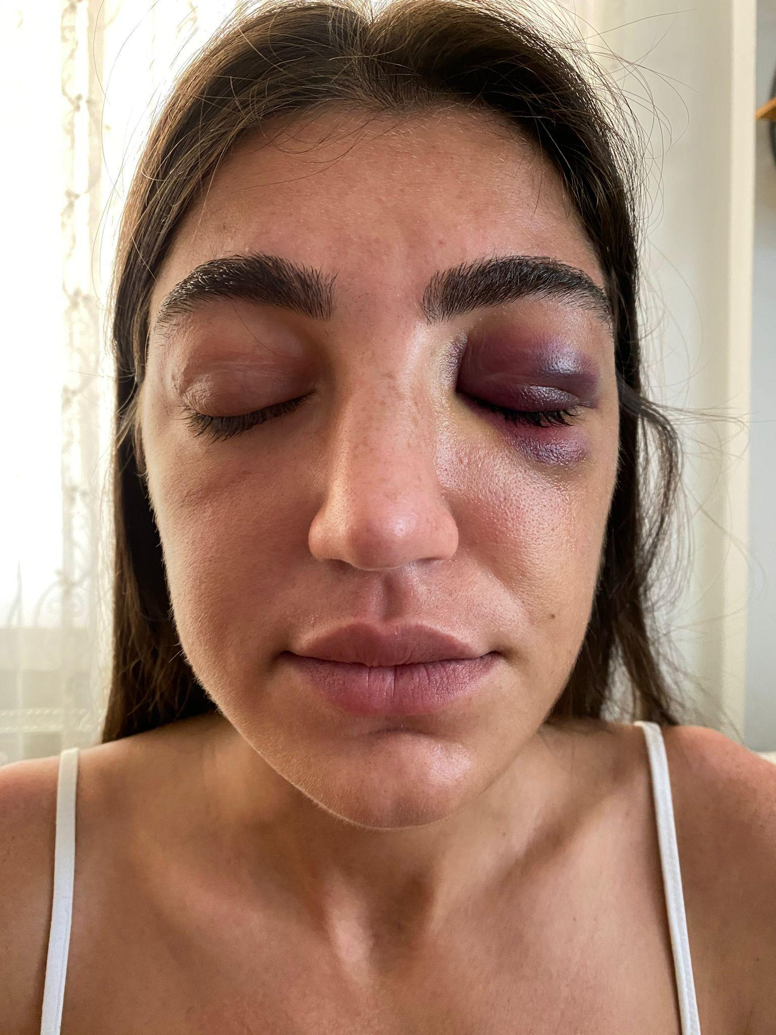 Mankene eski sevgili dehşeti: Acımasızca darp ettiği anlar kamerada