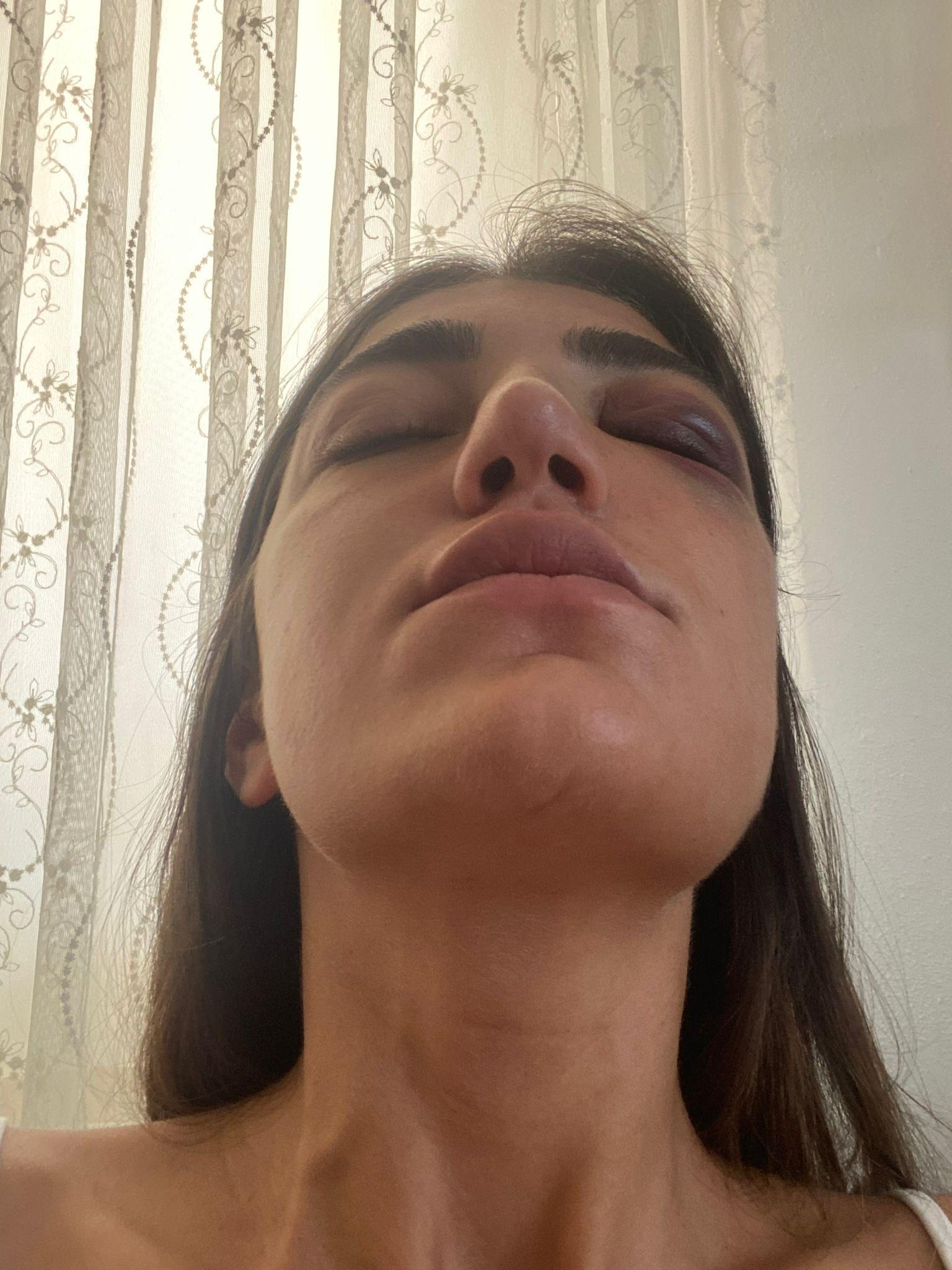 Mankene eski sevgili dehşeti: Acımasızca darp ettiği anlar kamerada