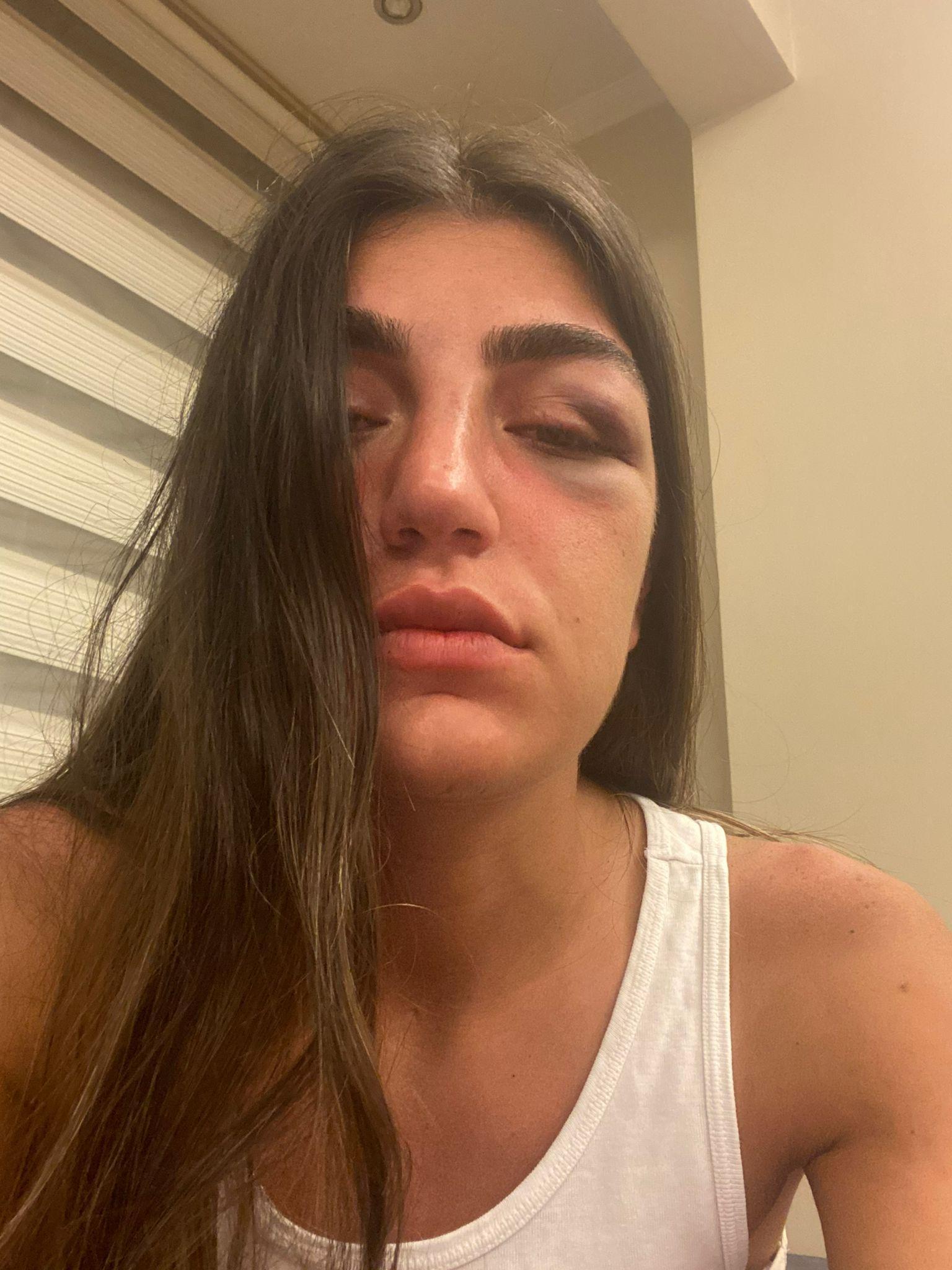 Mankene eski sevgili dehşeti: Acımasızca darp ettiği anlar kamerada