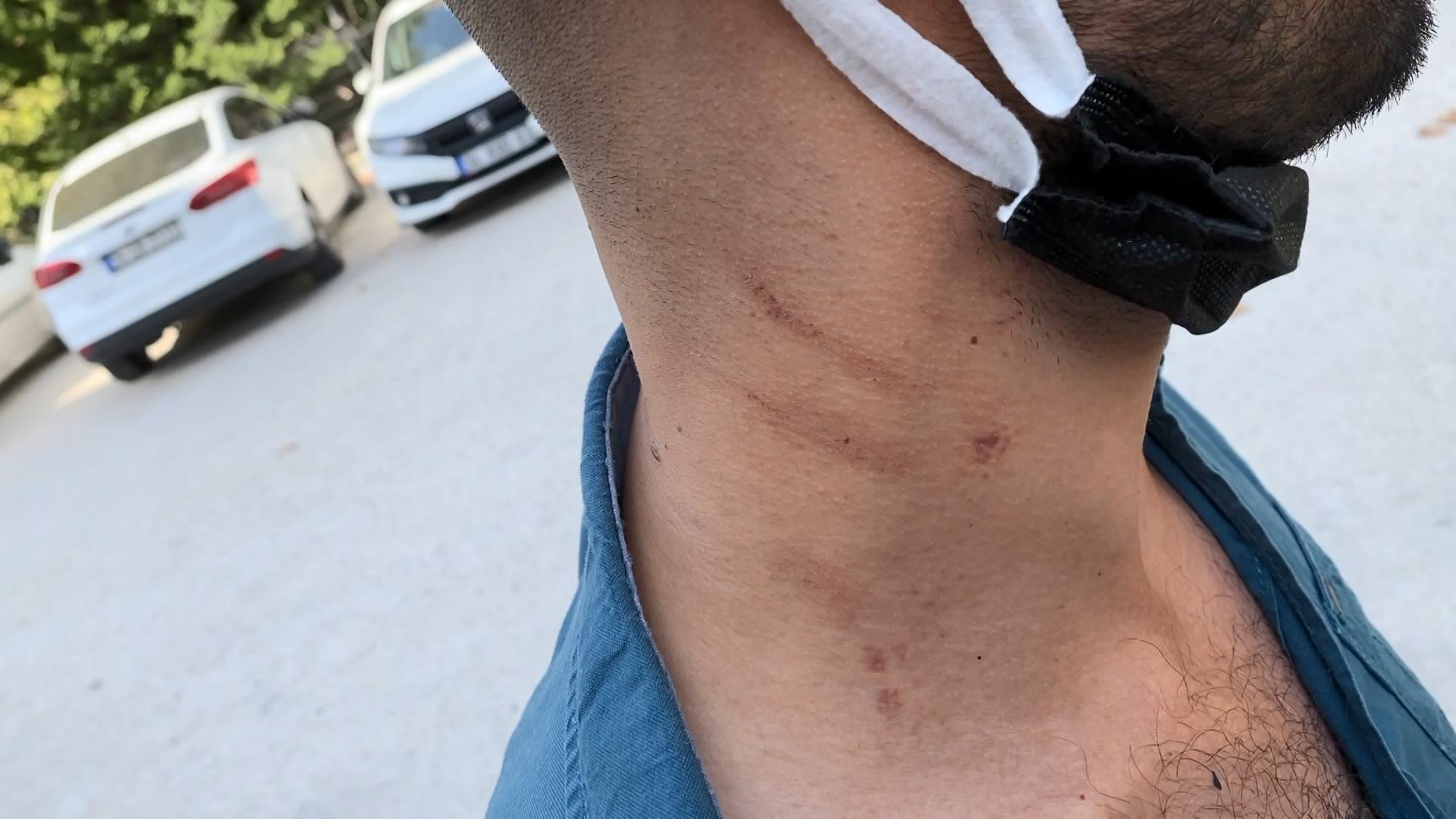 Sürücü adayına dehşeti yaşatmışlardı; olaydan önce de kavga ettikleri ortaya çıktı