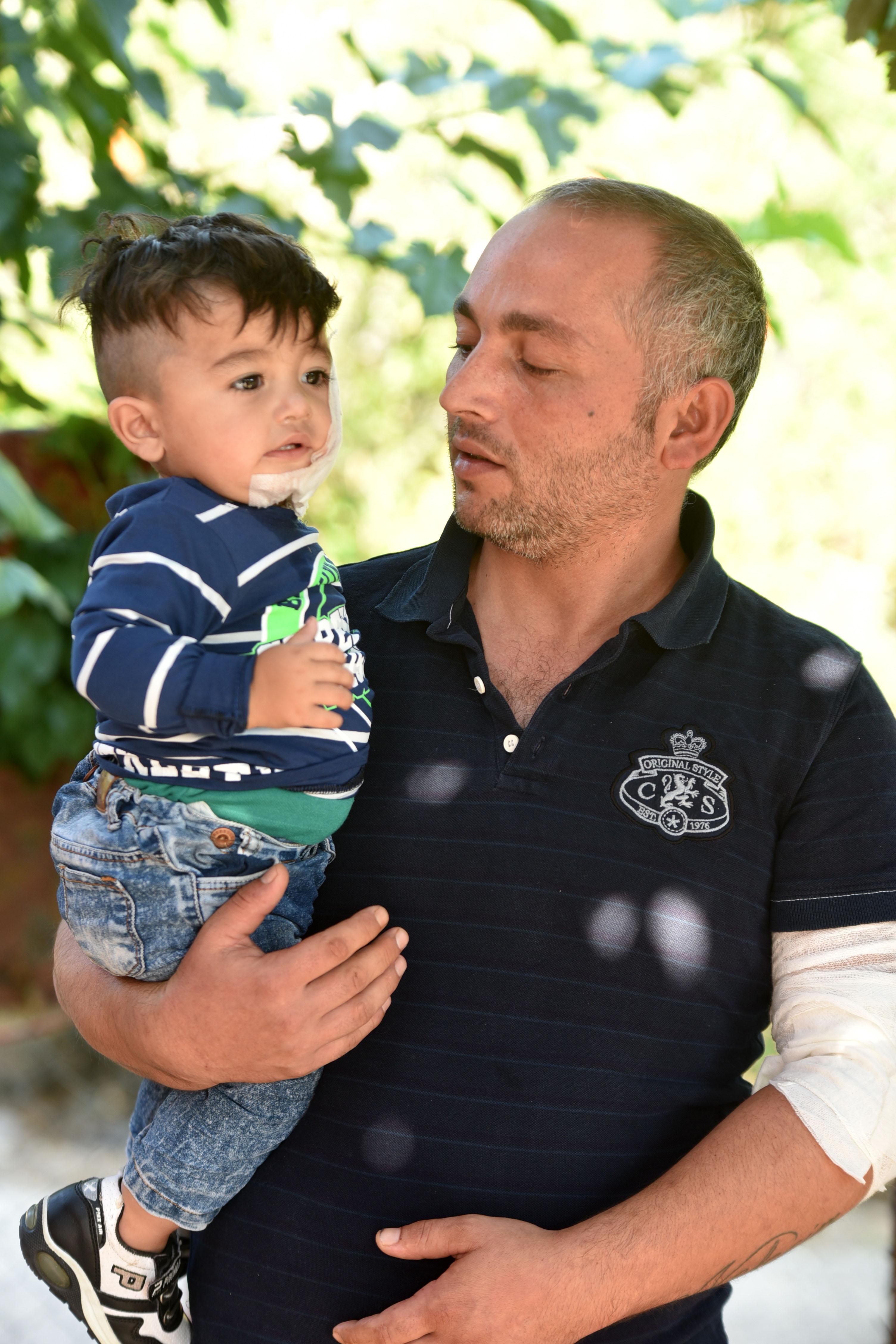 Antalyada pitbull, 11 aylık bebeğin yanağını ve kulağını kopardı