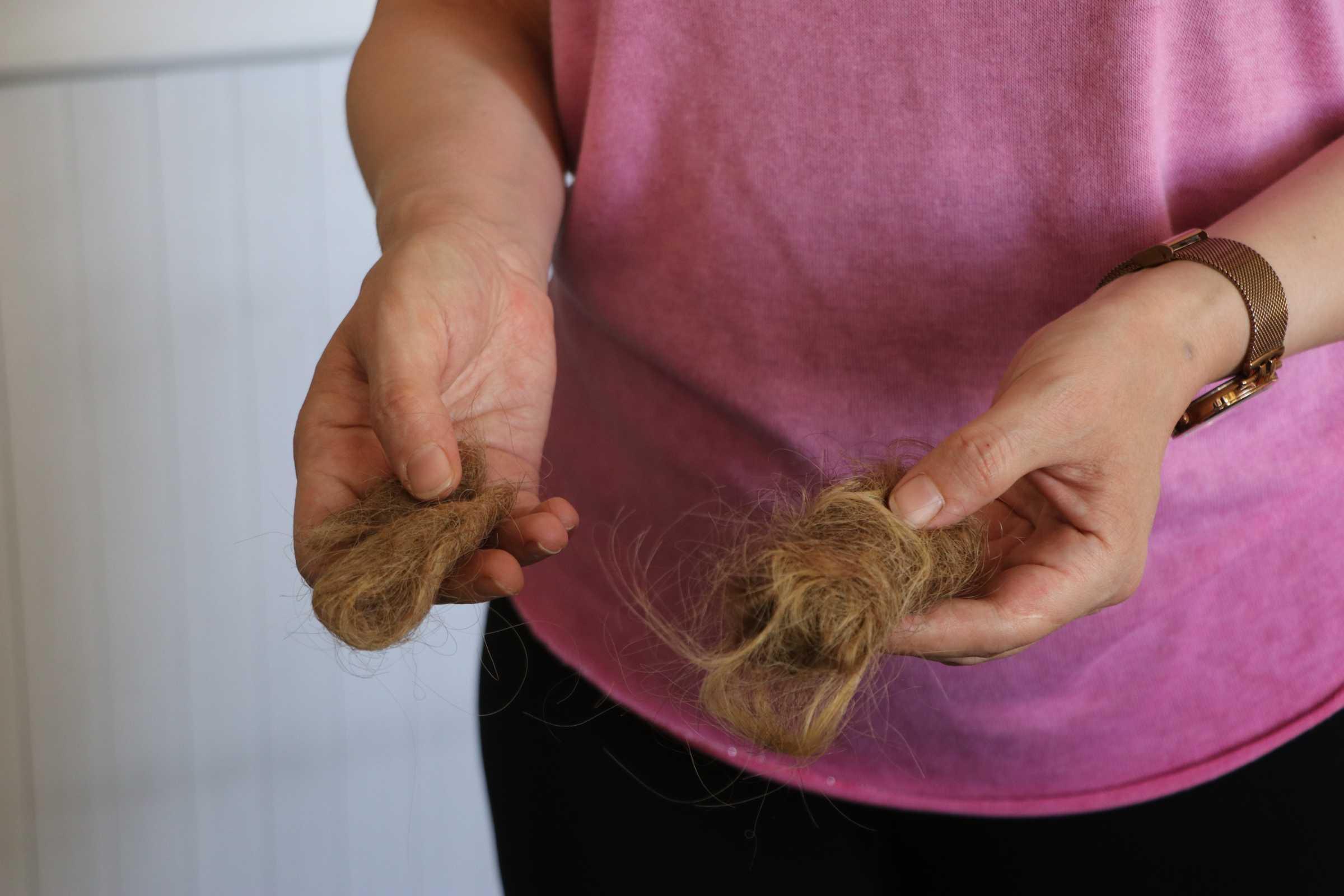 Kadın hasta hemşireyi darbedip, saçlarını yoldu