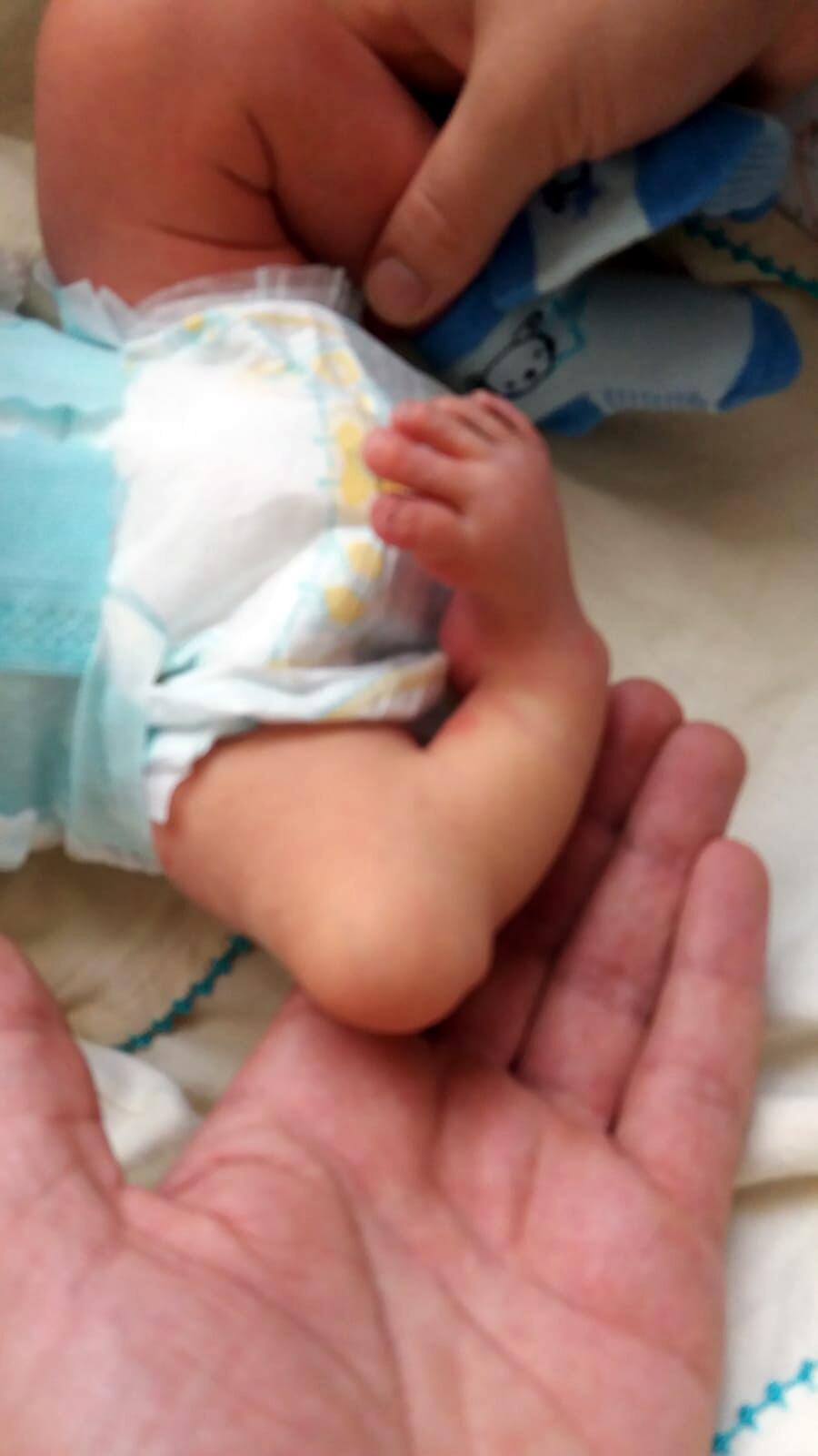 6 ameliyat geçiren Yusuf Kamil artık yürüyebiliyor