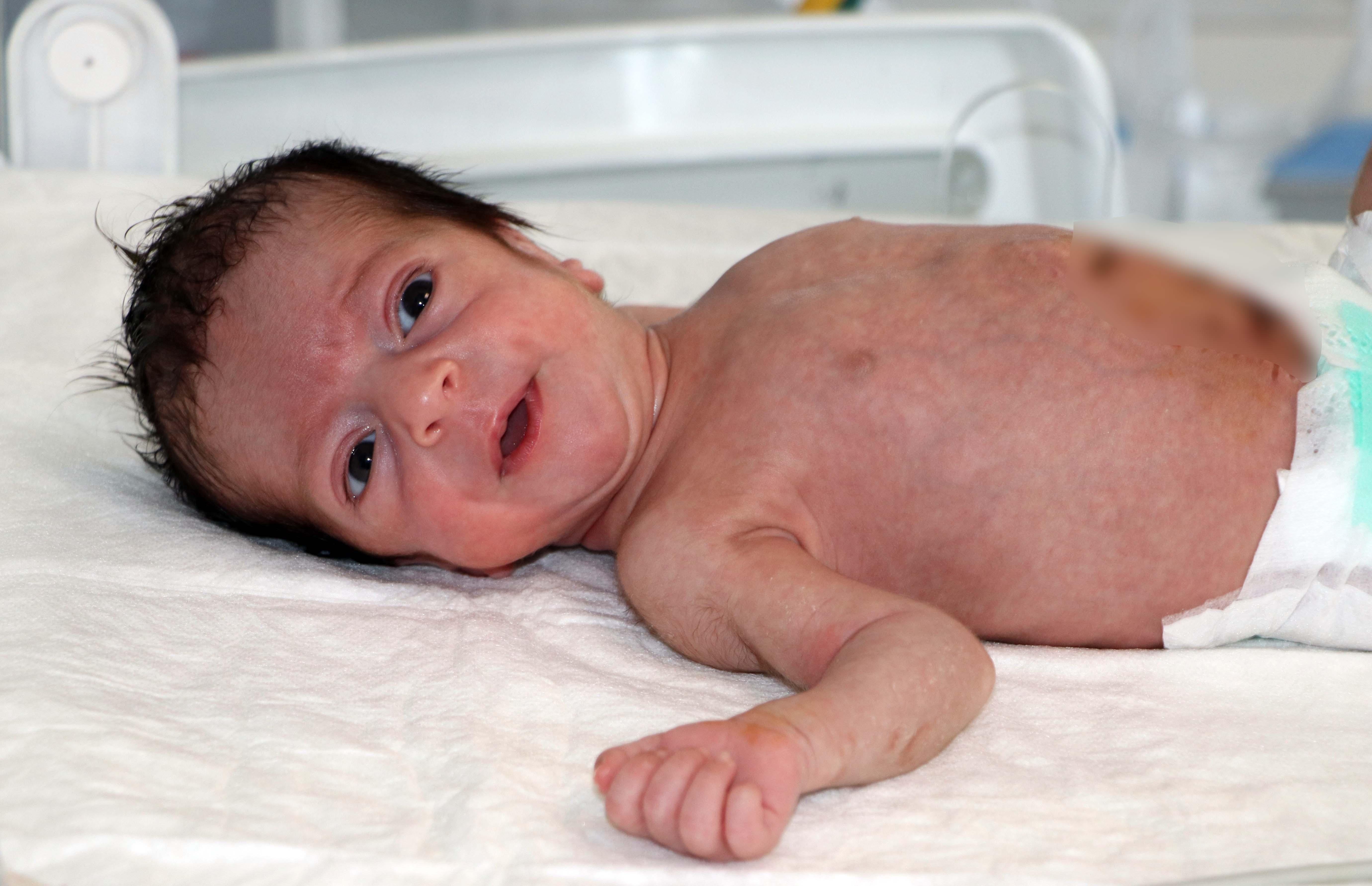 Nesrin bebek sağlığına kavuştu