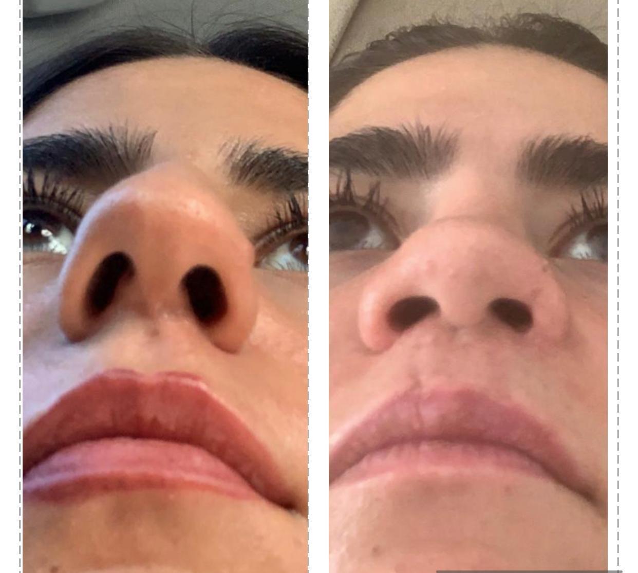 Avusturyadan İstanbula gelen genç kadına evlilik öncesi estetik şoku