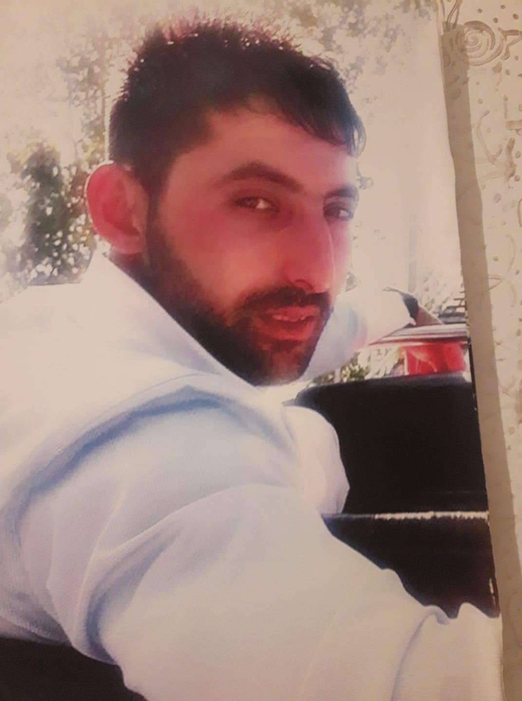 Yüzünün yarısını kaybeden Ahmetin tek hayali normal insanlar gibi yaşamak