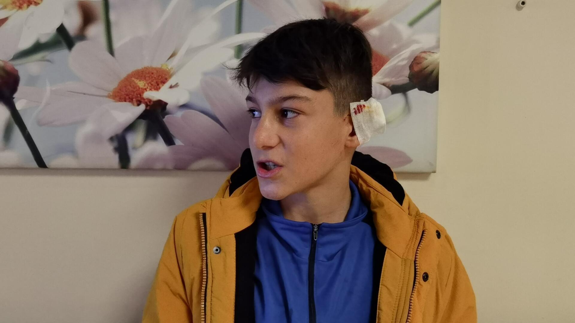 Alman çoban köpeğinin saldırdığı Yusufun kulağında doku kaybı var