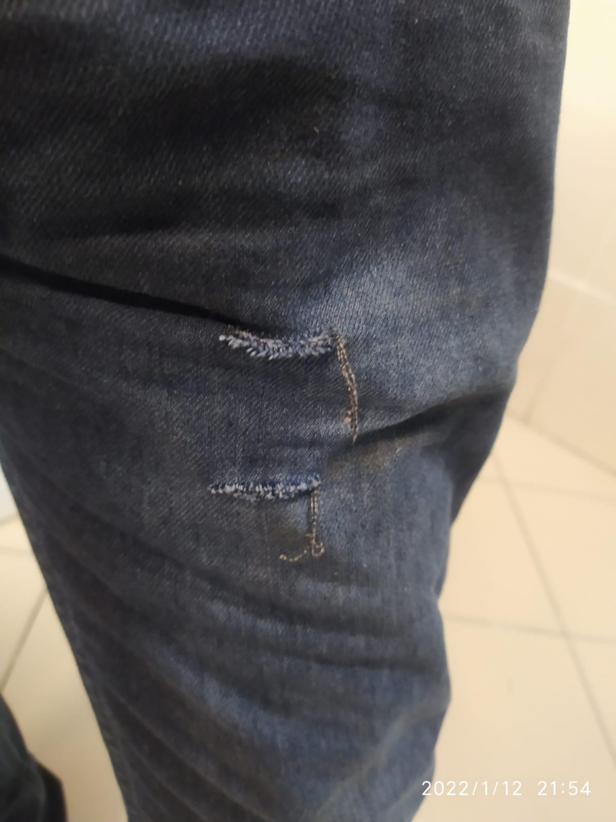 Köpeklerin saldırısına uğrayan baba- oğul yaralandı