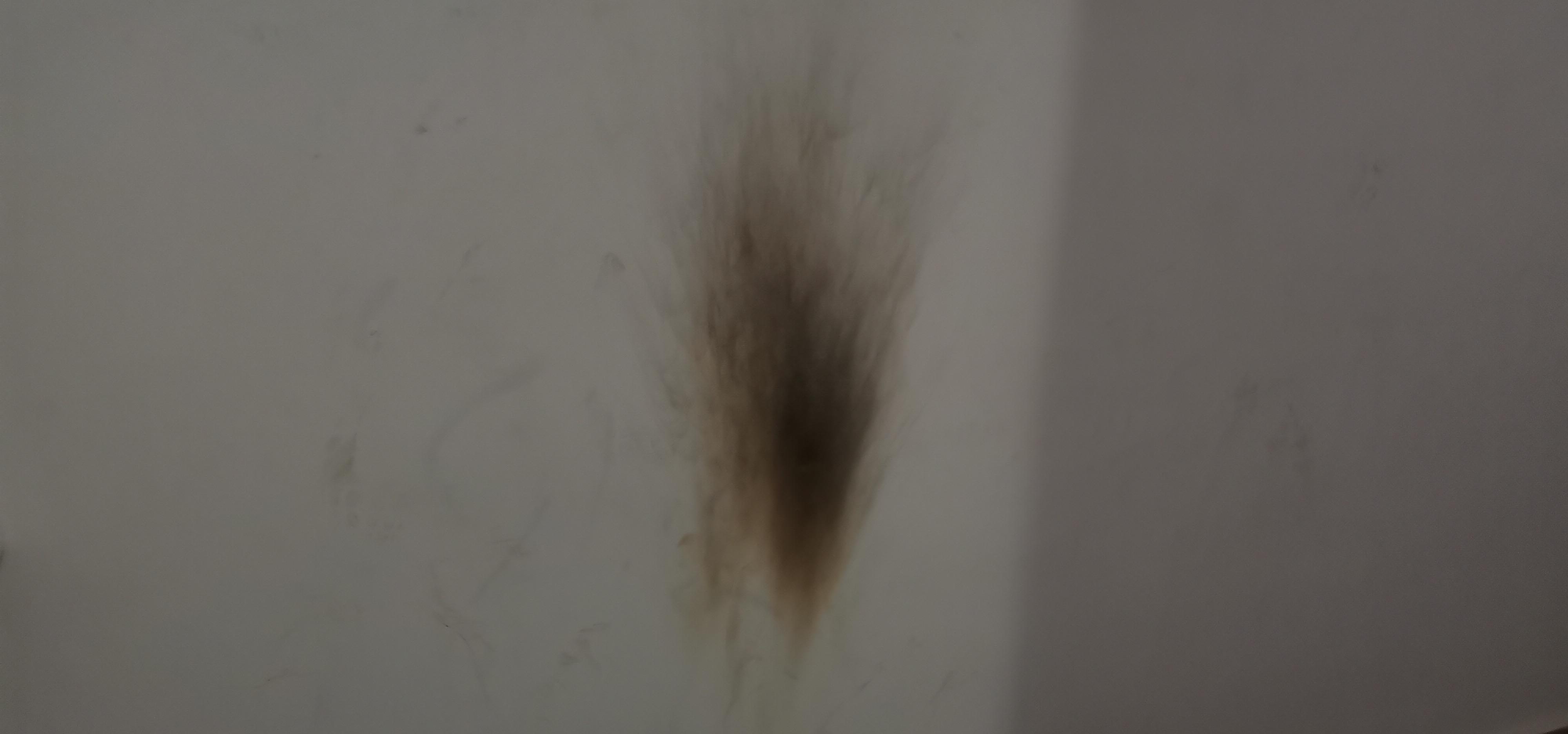 Eski eşinin üzerine yanıcı madde döküp yaktığı Elvan, ağır yaralandı