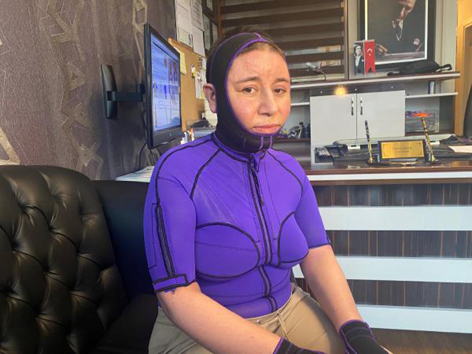 Eşini, benzin dökerek yakan kocanın müebbet hapsi istendi