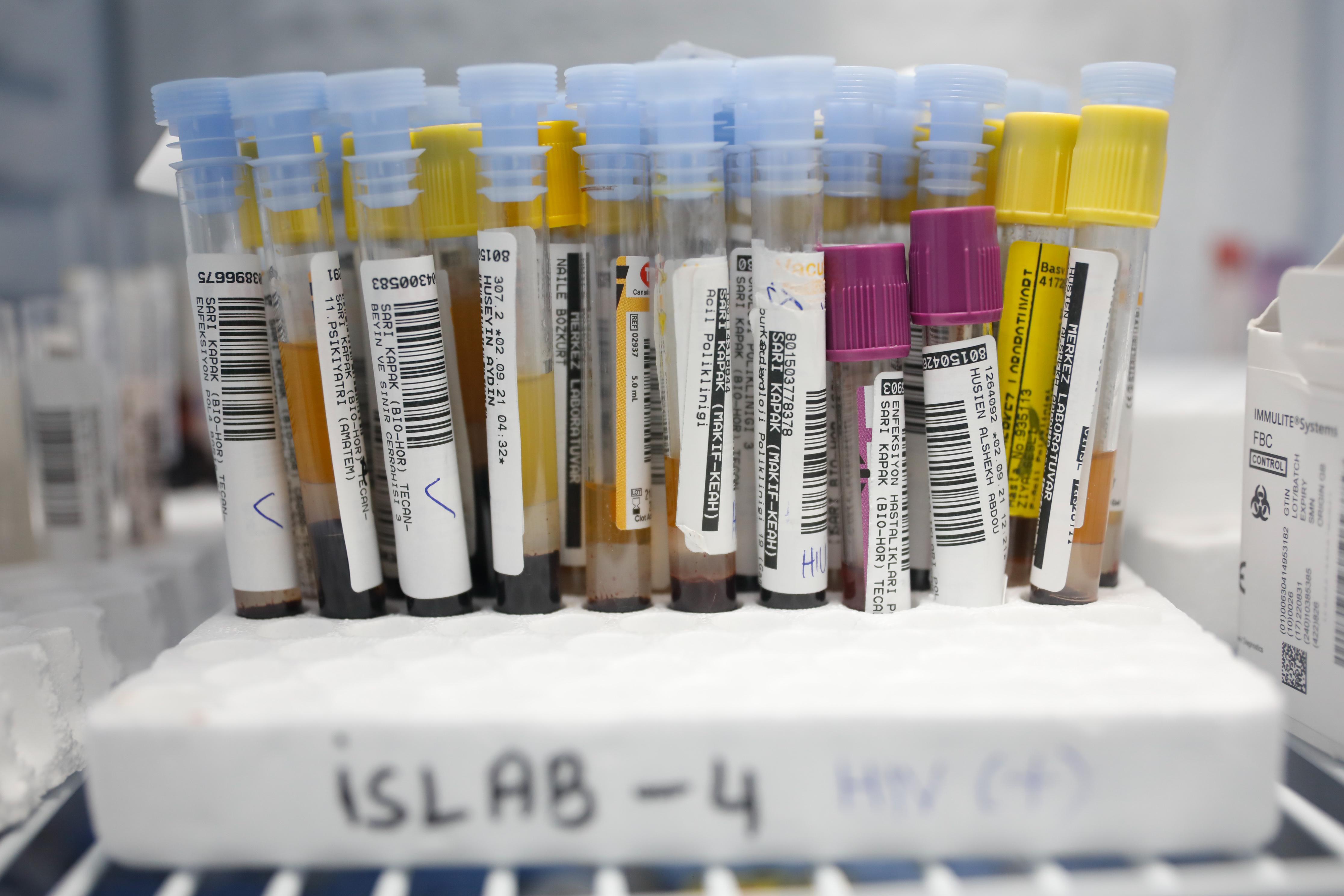 İSLAB Projesi ile İstanbulun tüm testleri tek çatı altında