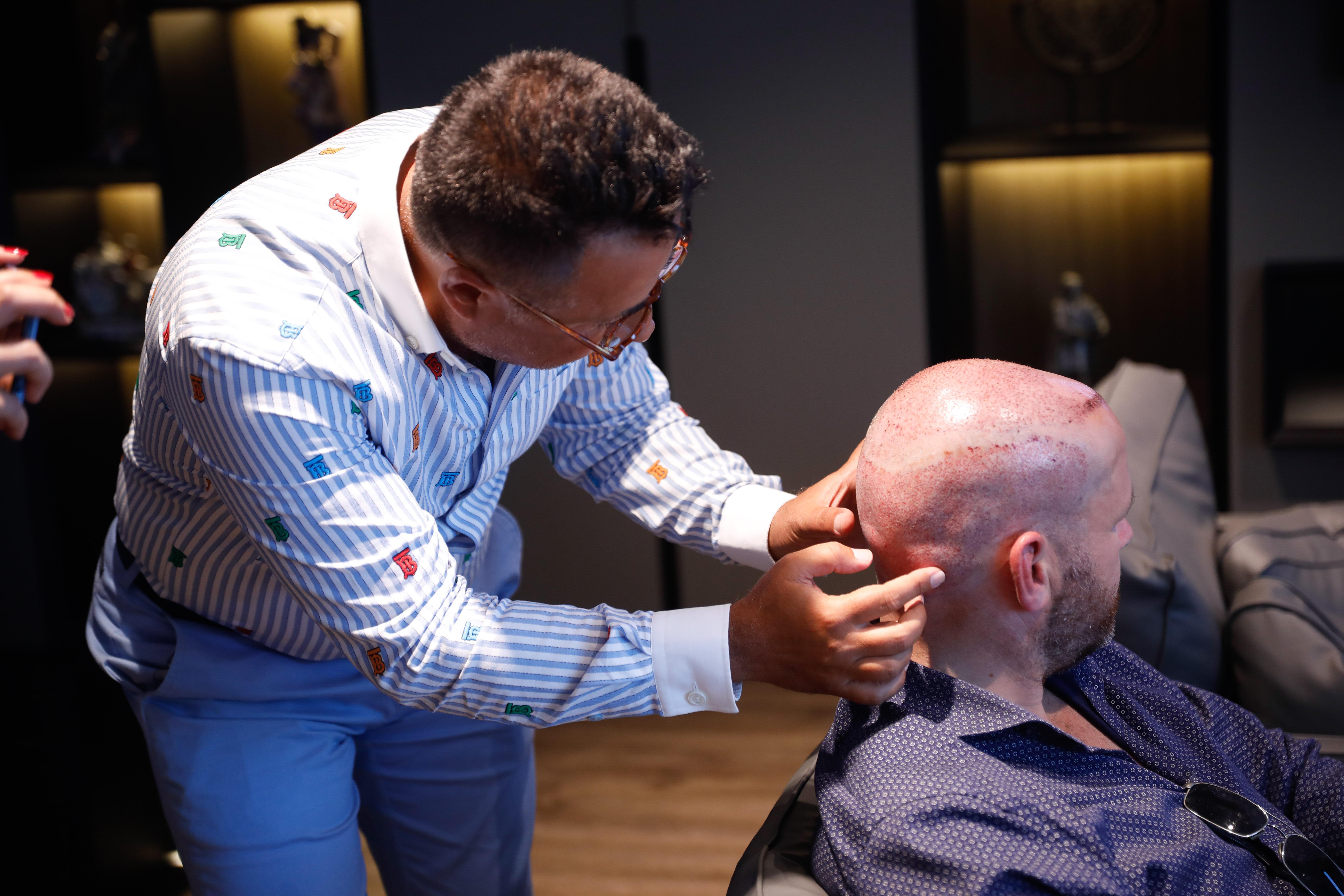 Saç ekimi için en çok Almanyadan geliyorlar