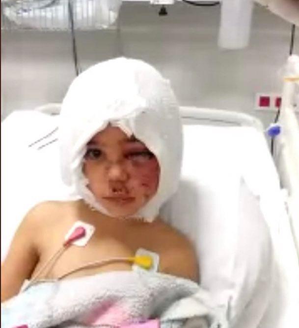 Pitbull saldırısına ilişkin görüntülerin bir kısmı silinmiş