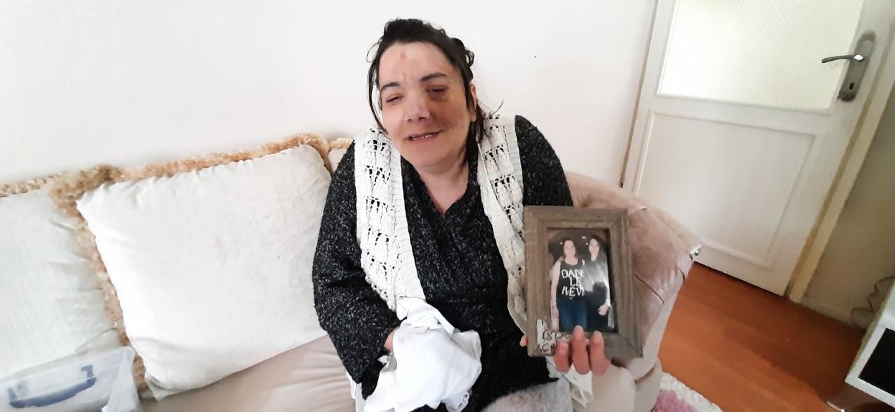 Damak tedavisinde yüz felci olan Yeliz, hayatını kaybetti