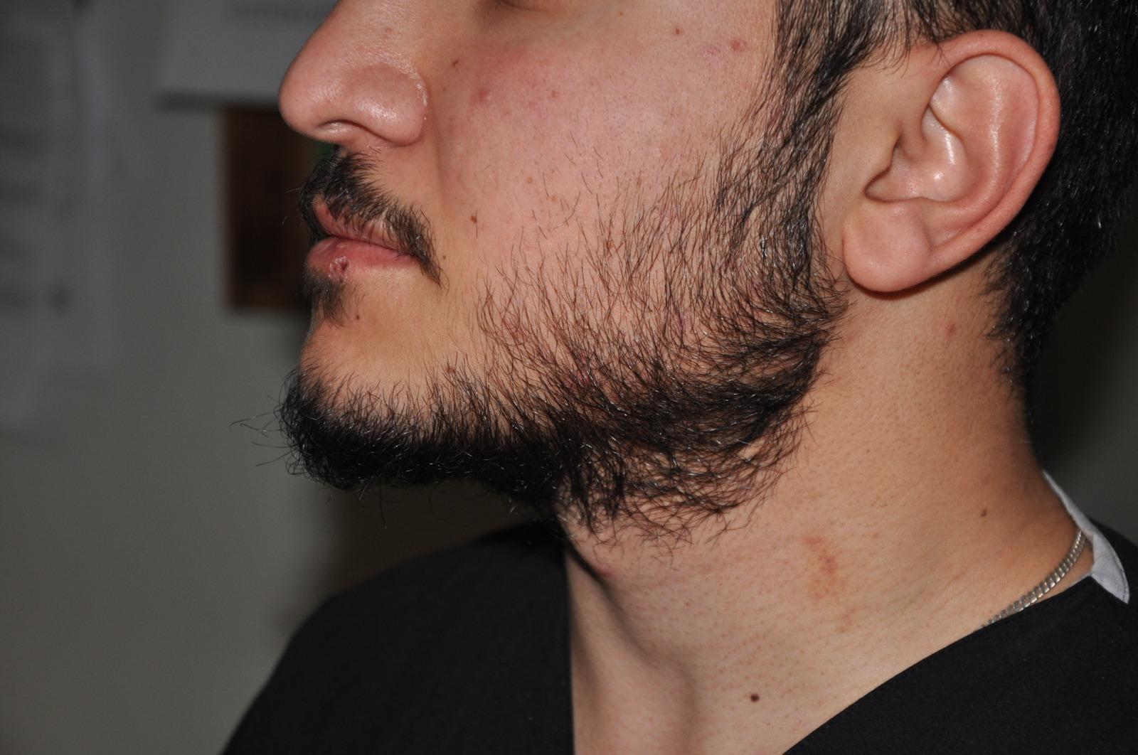 Hasta yakını, hemşireyi dövdü