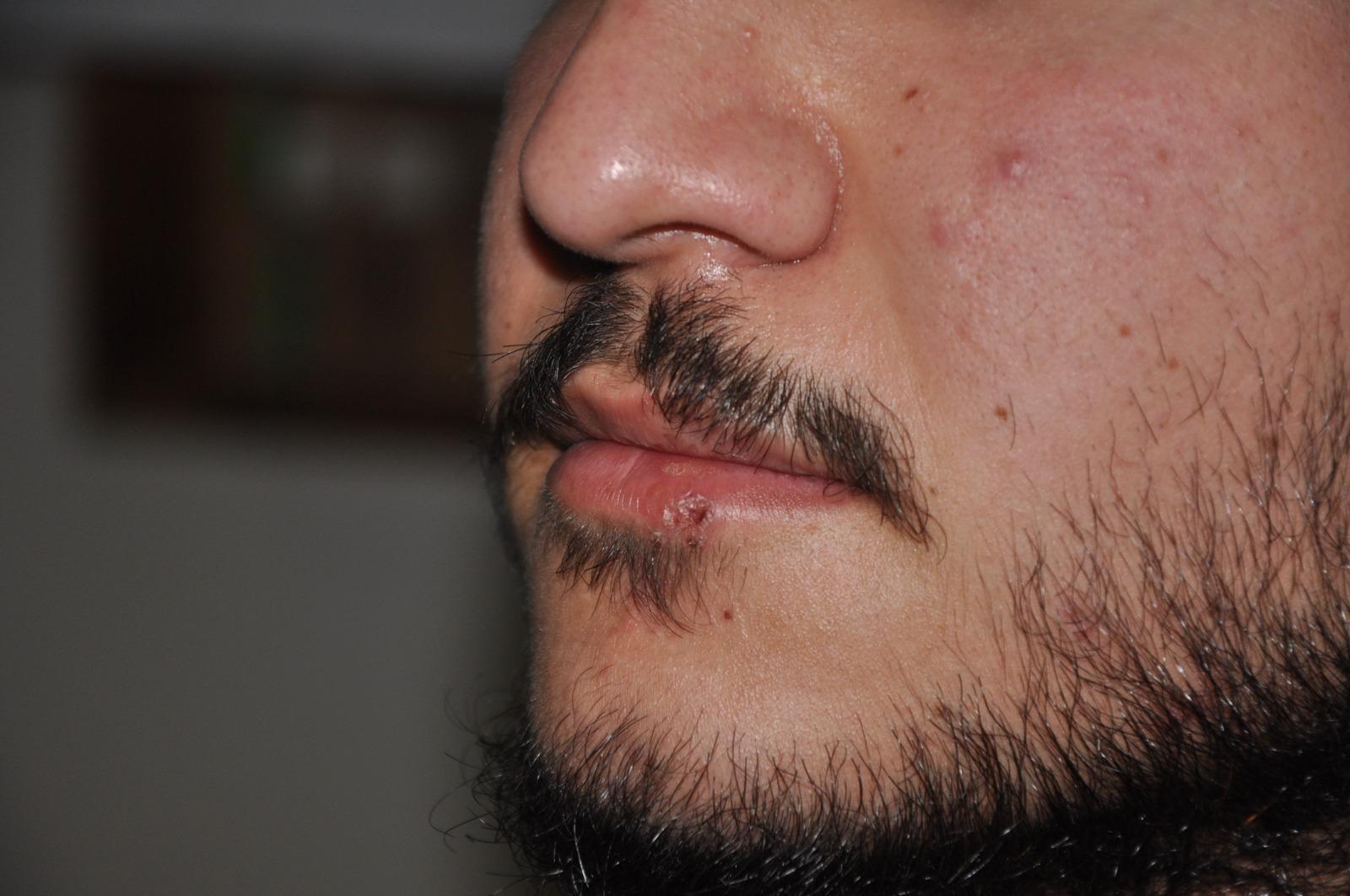 Hasta yakını, hemşireyi dövdü